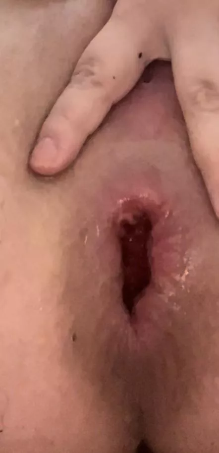 My favorite is when my asshole gets a long slit and looks like my pussy