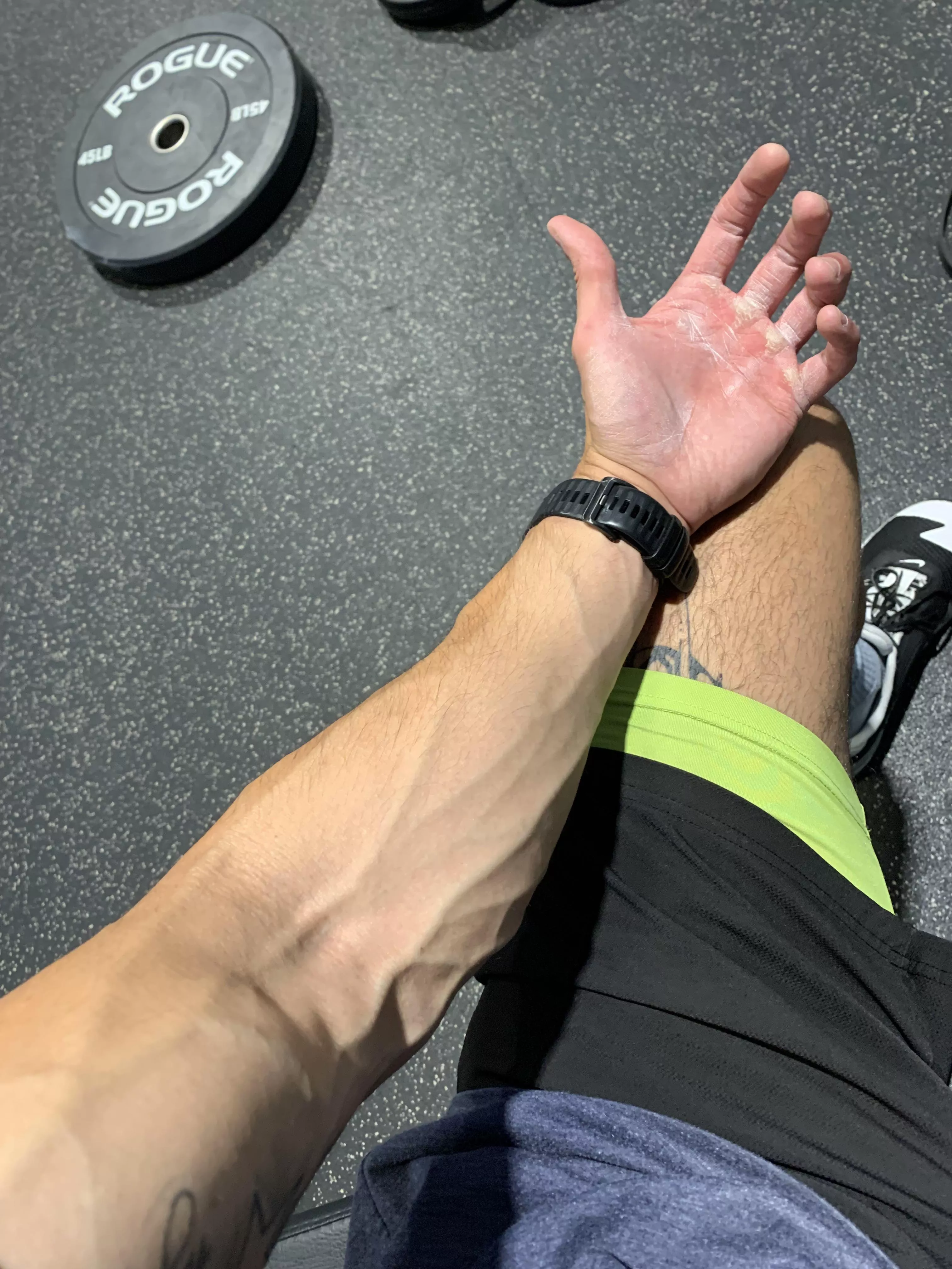 Veins and lifting chalk