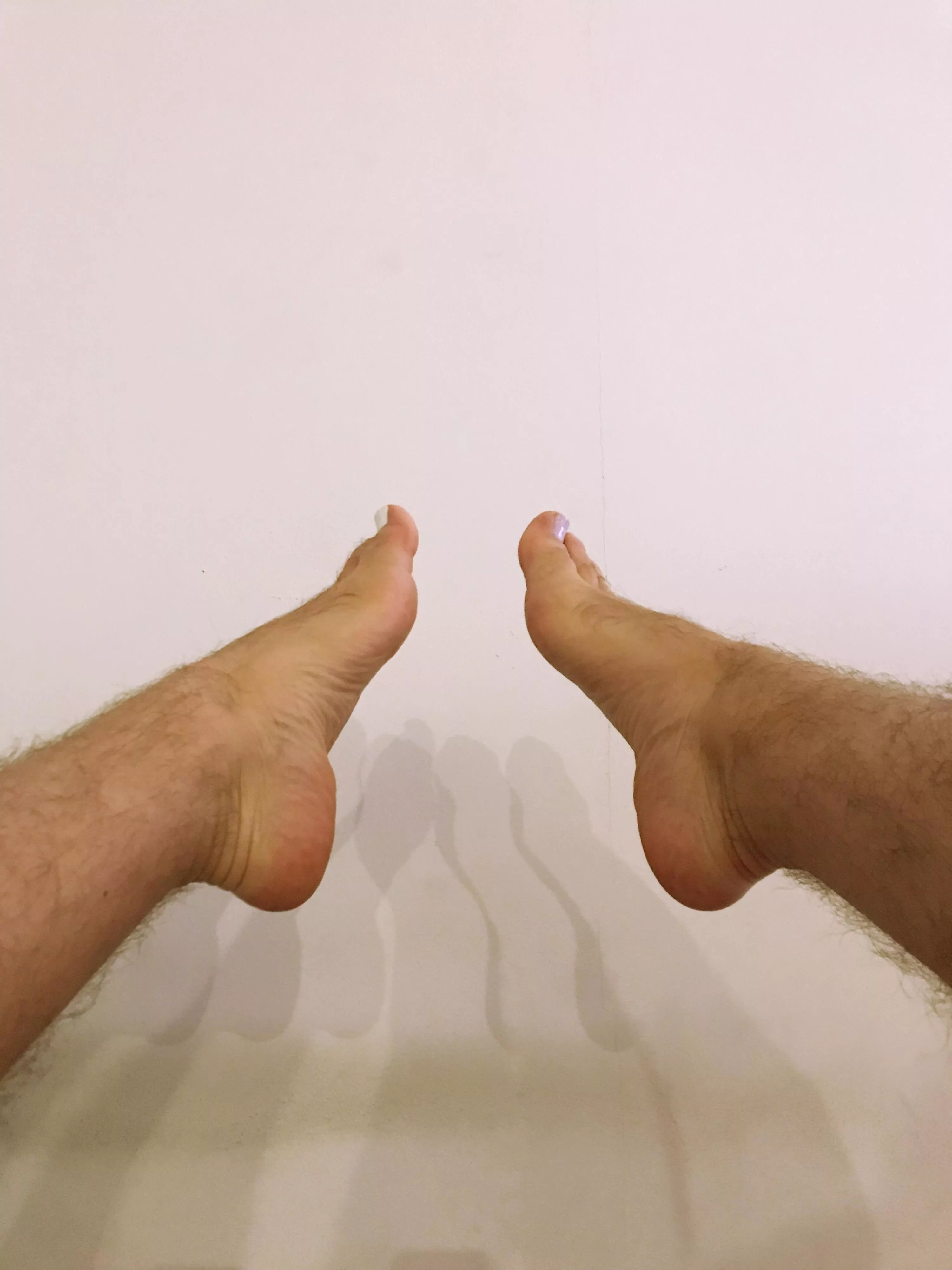 My hairy legs