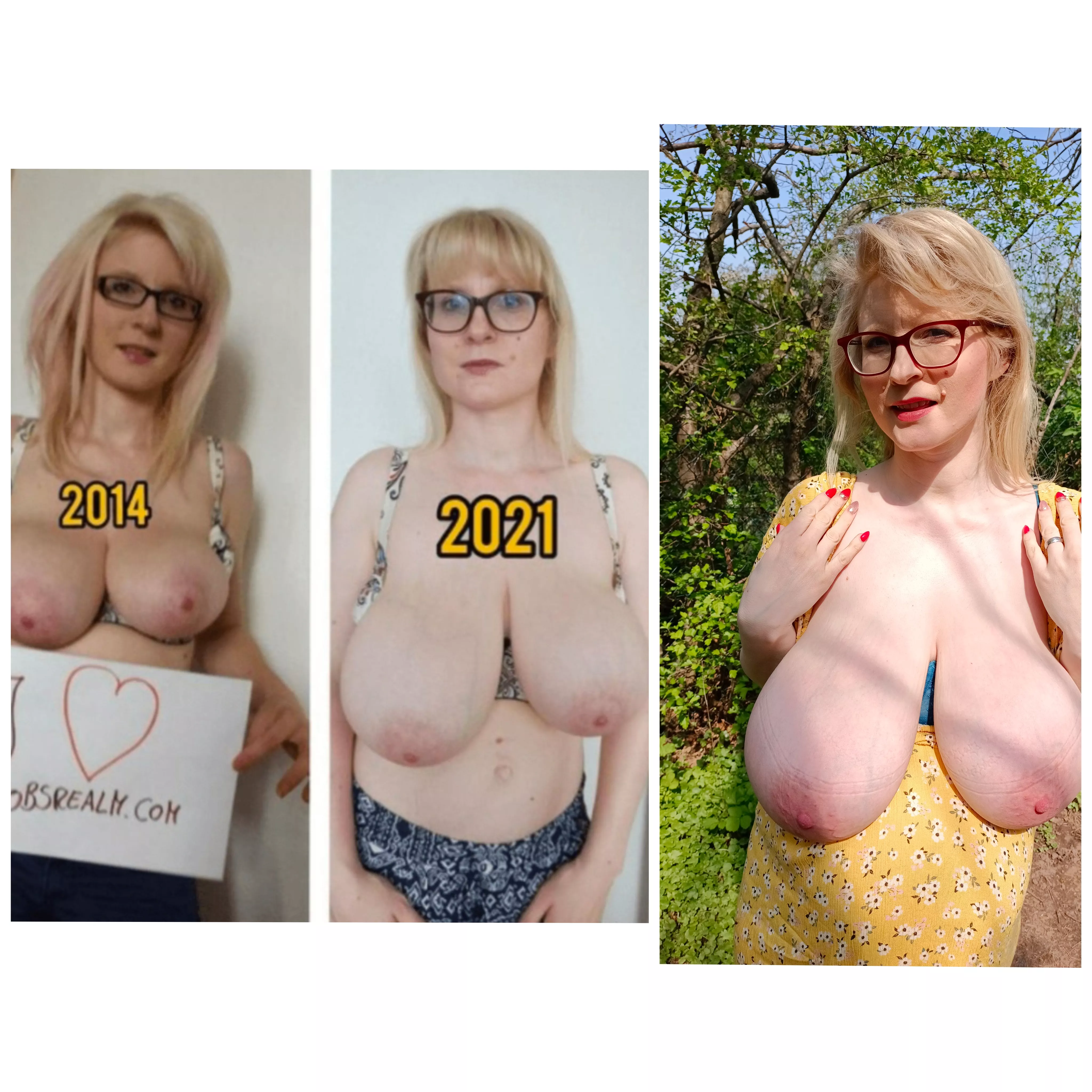 Breast grow in last 8 years.