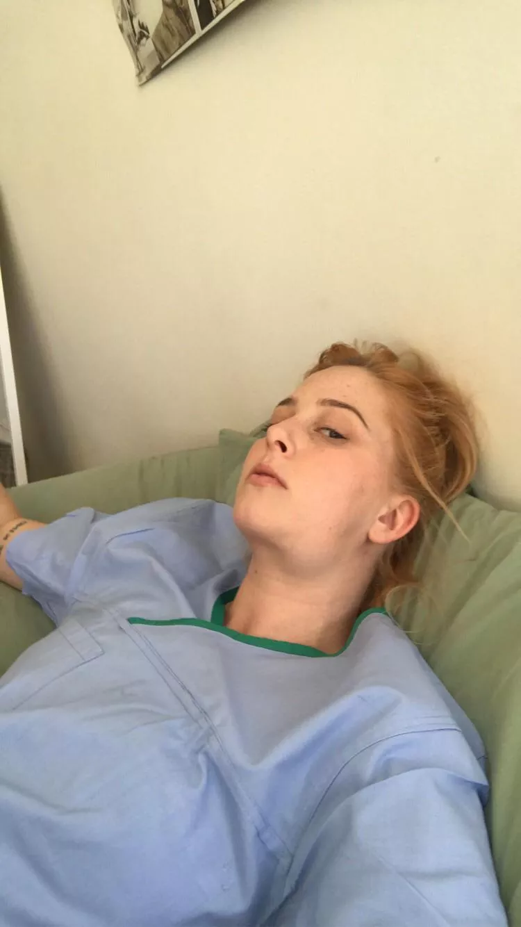 I’ve seen those videos of people pushing out tonsil stones, what’s the trick? I’ve had mine for almost 12 months and it always swells when I eat (v hot photo of me)