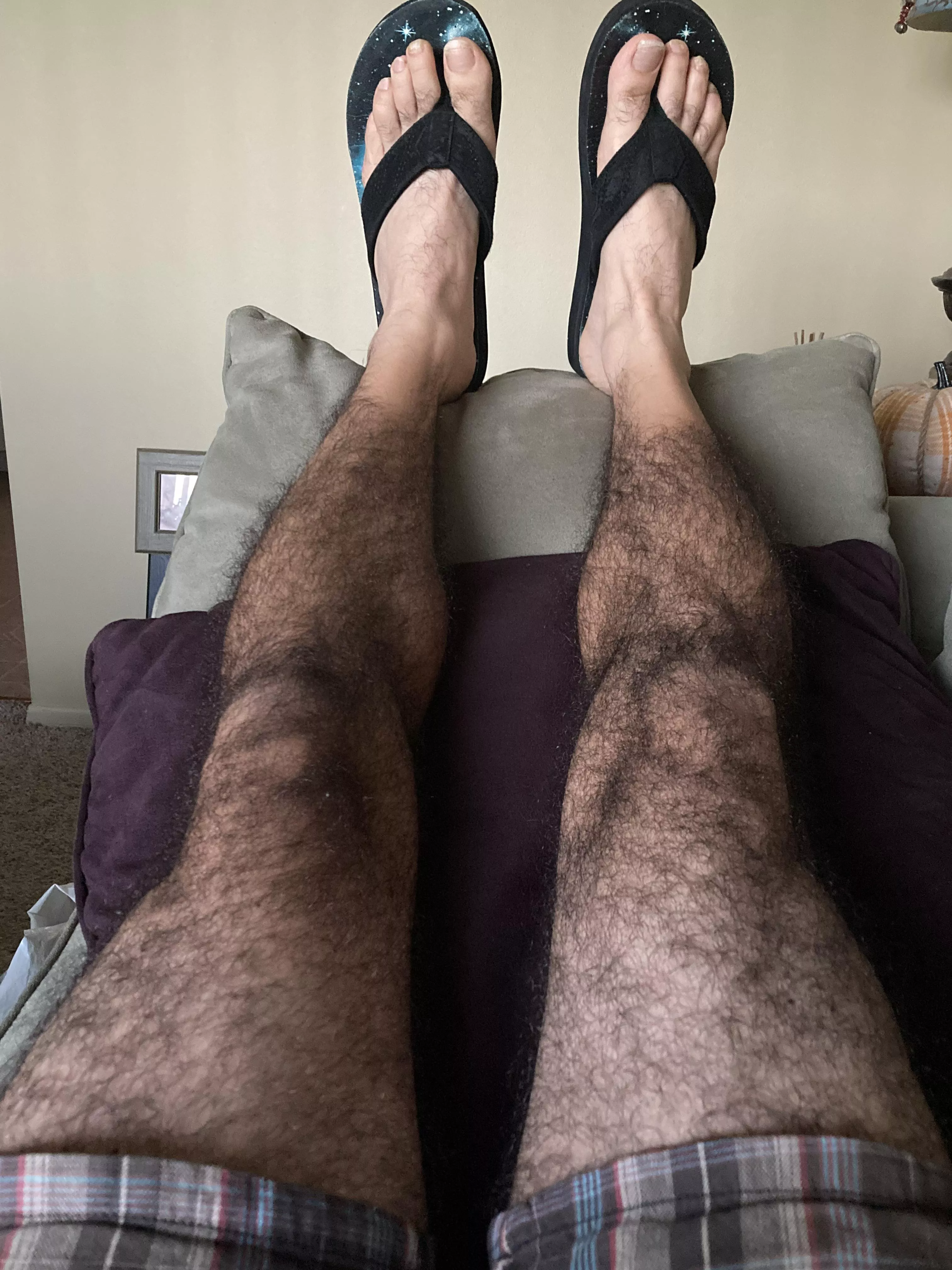 Insanely hairy legs