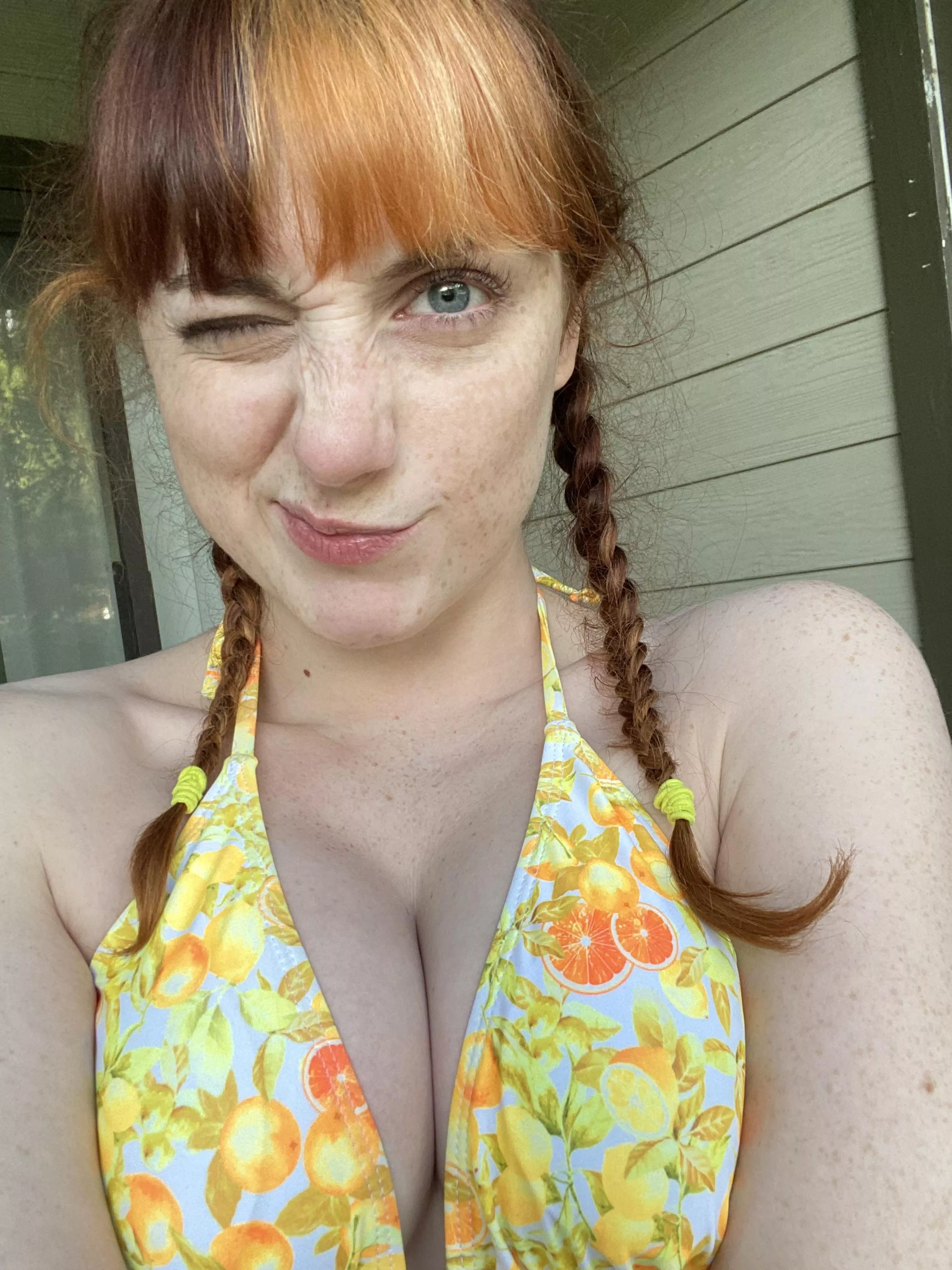 Skin is burnt, but freckles are poppin’! ;)