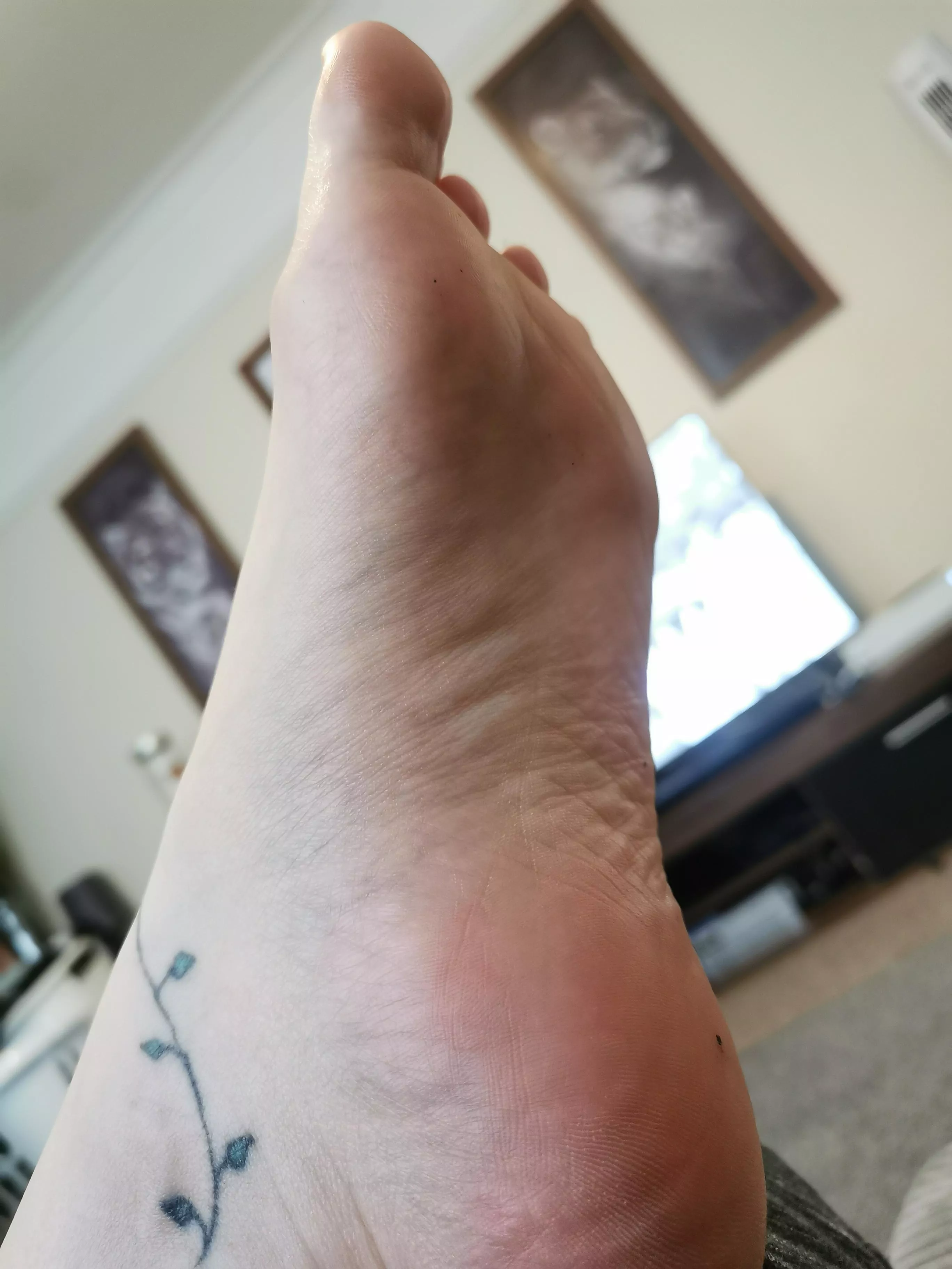 thoughts on my wrinkly soles?