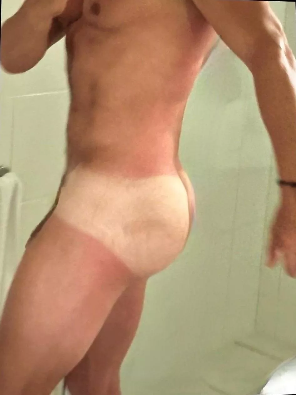 Tan line