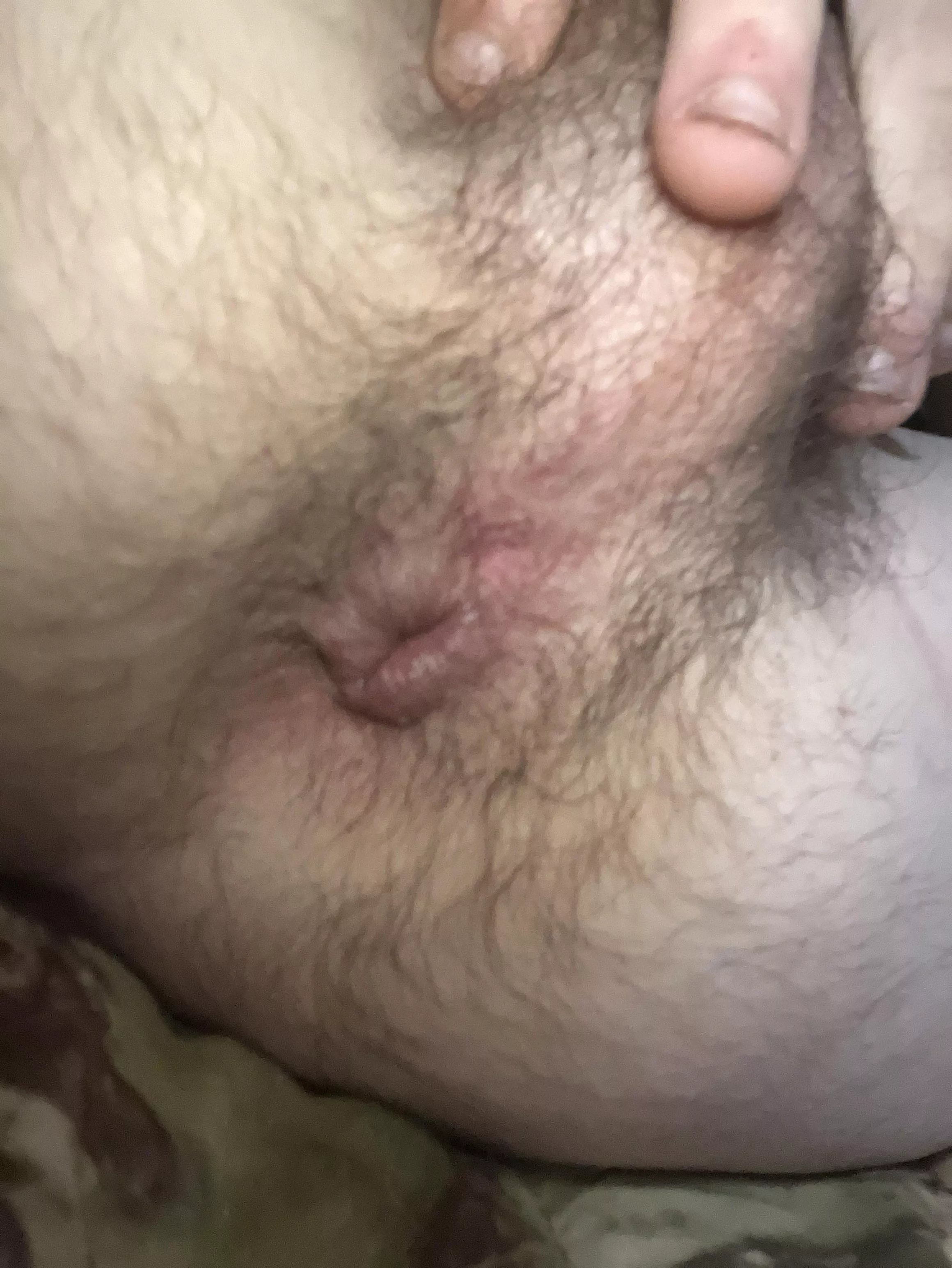 Hairy hole