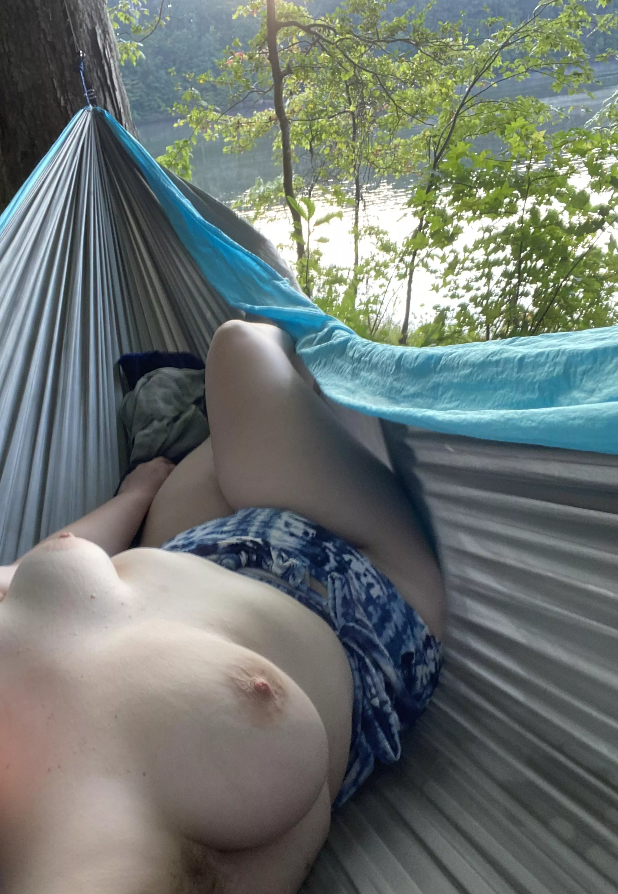 Fell asleep exposed in my hammock