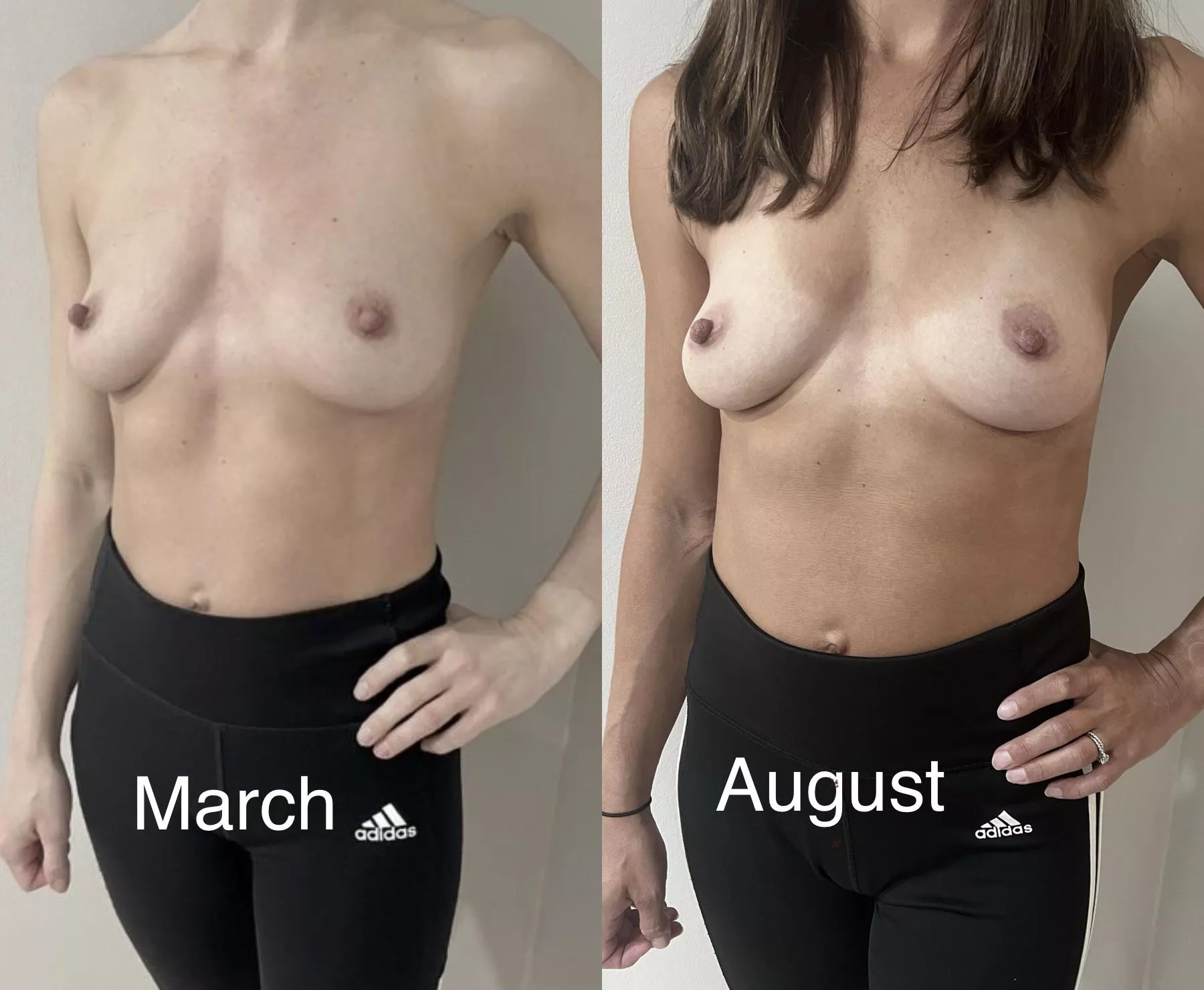 Do you think my boobs grew from March to August