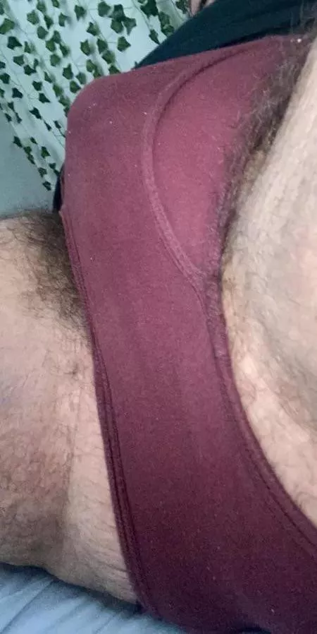 Hairy bulge