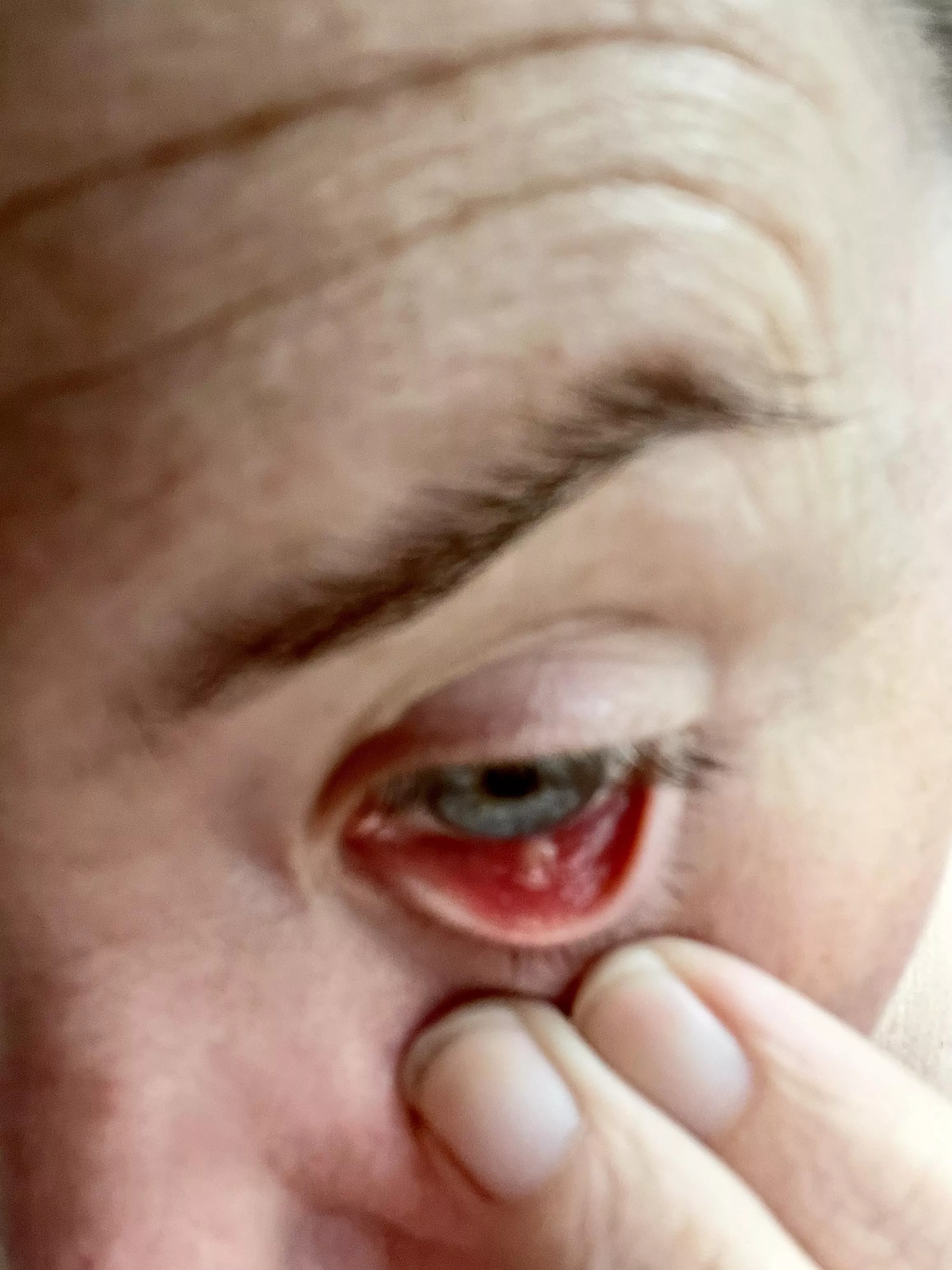 Owie! Forbidden stye pop