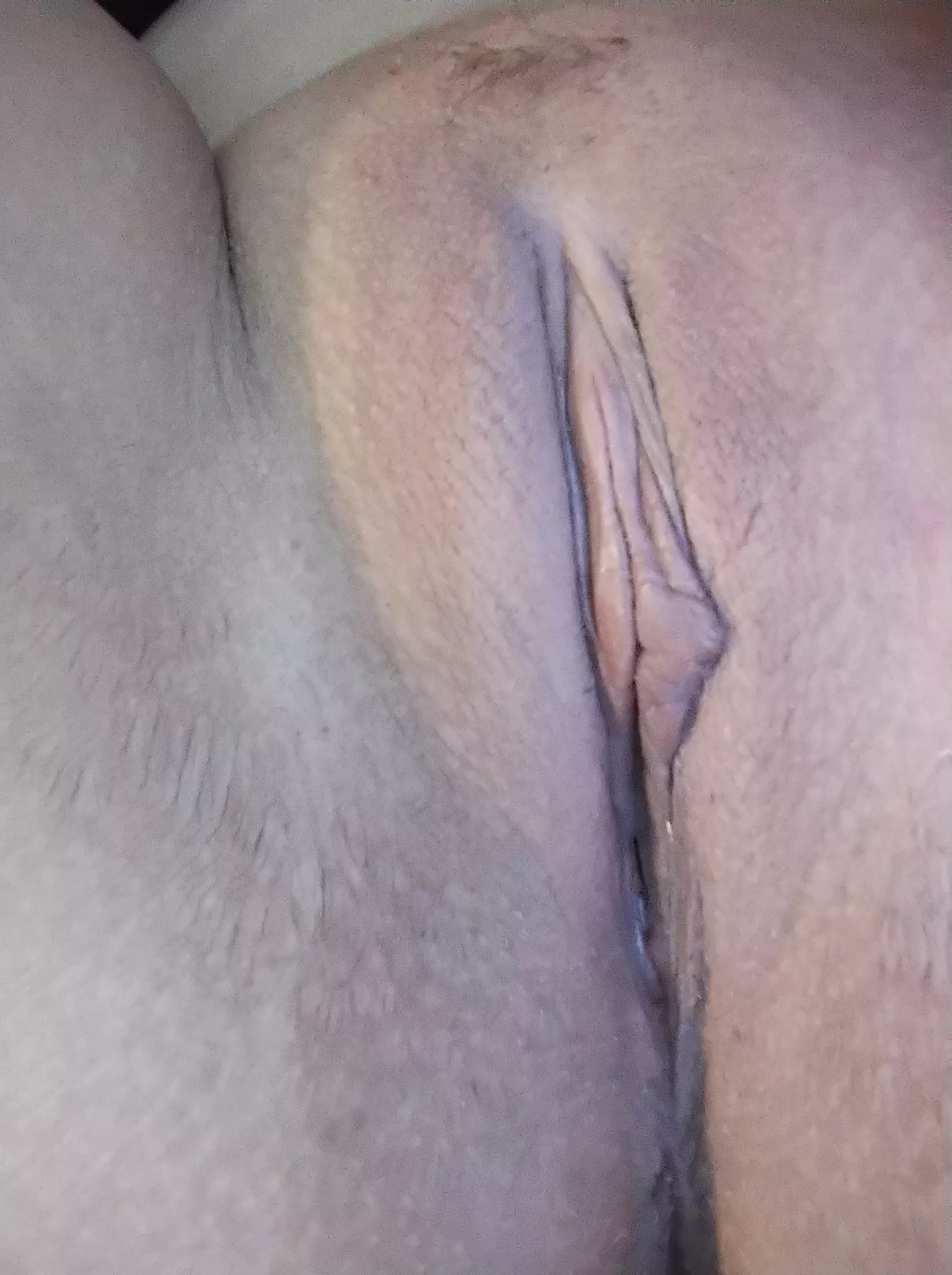 (F) Just a close up of my slit