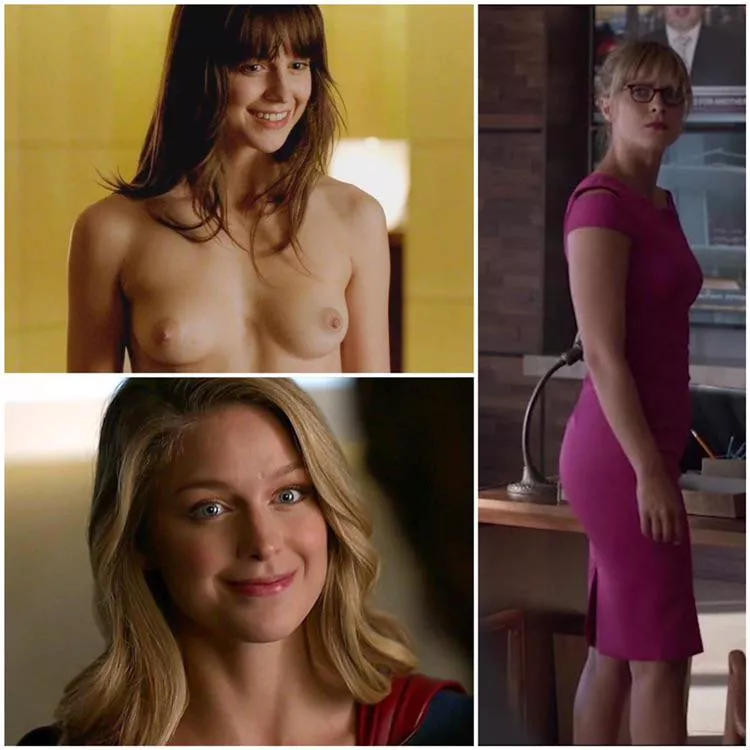 Melissa Benoist