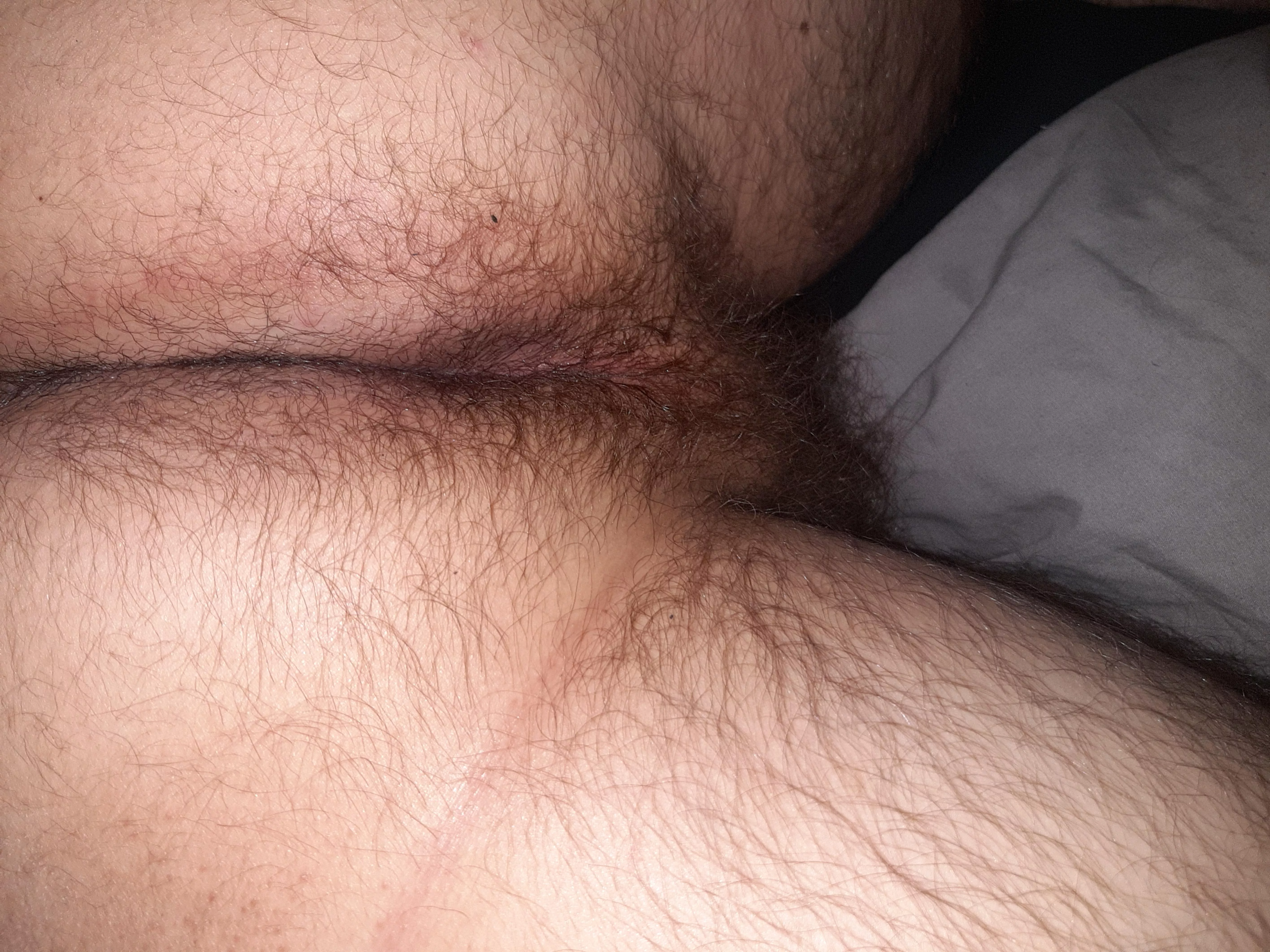 Hairy enough?