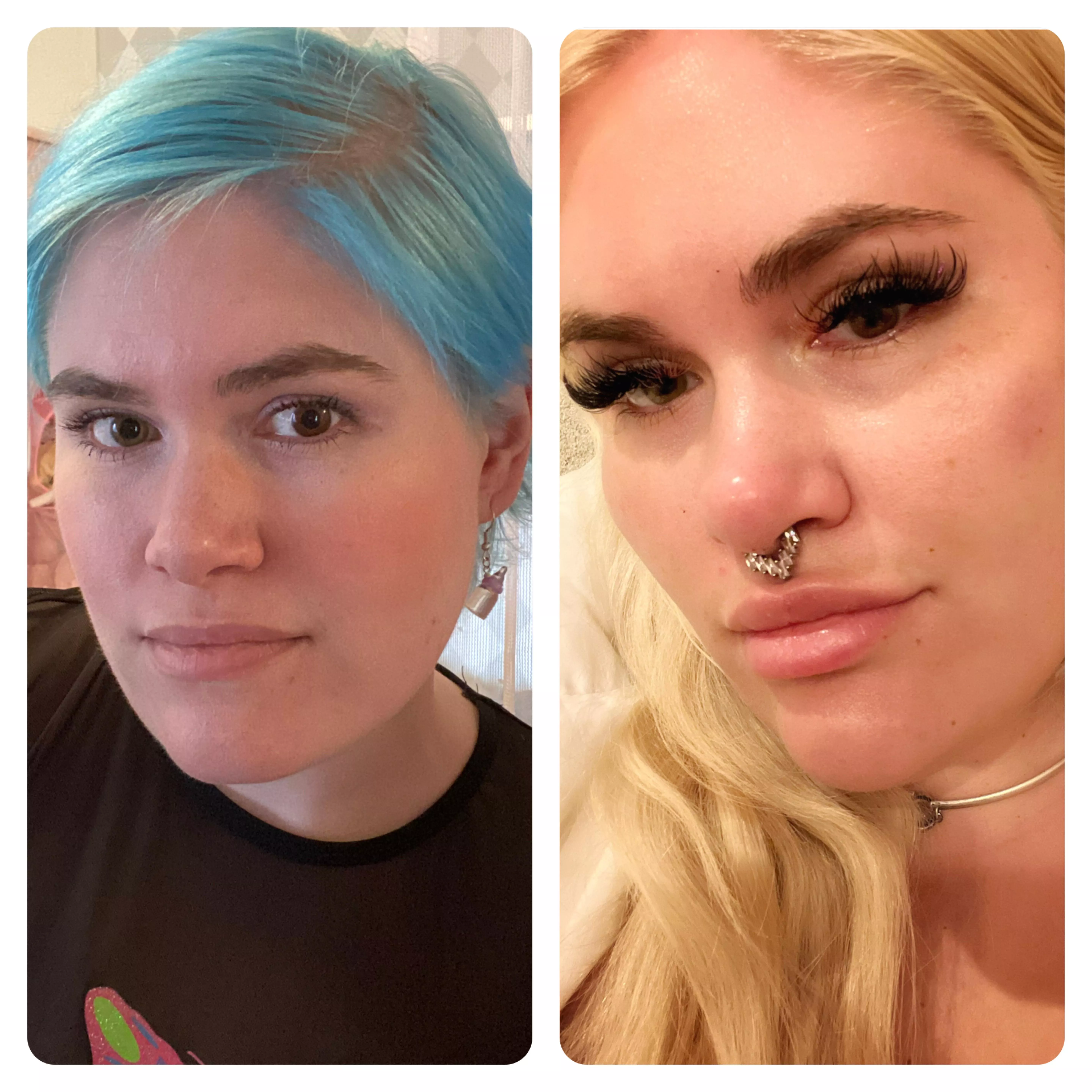 How my face has changed (no makeup-version)