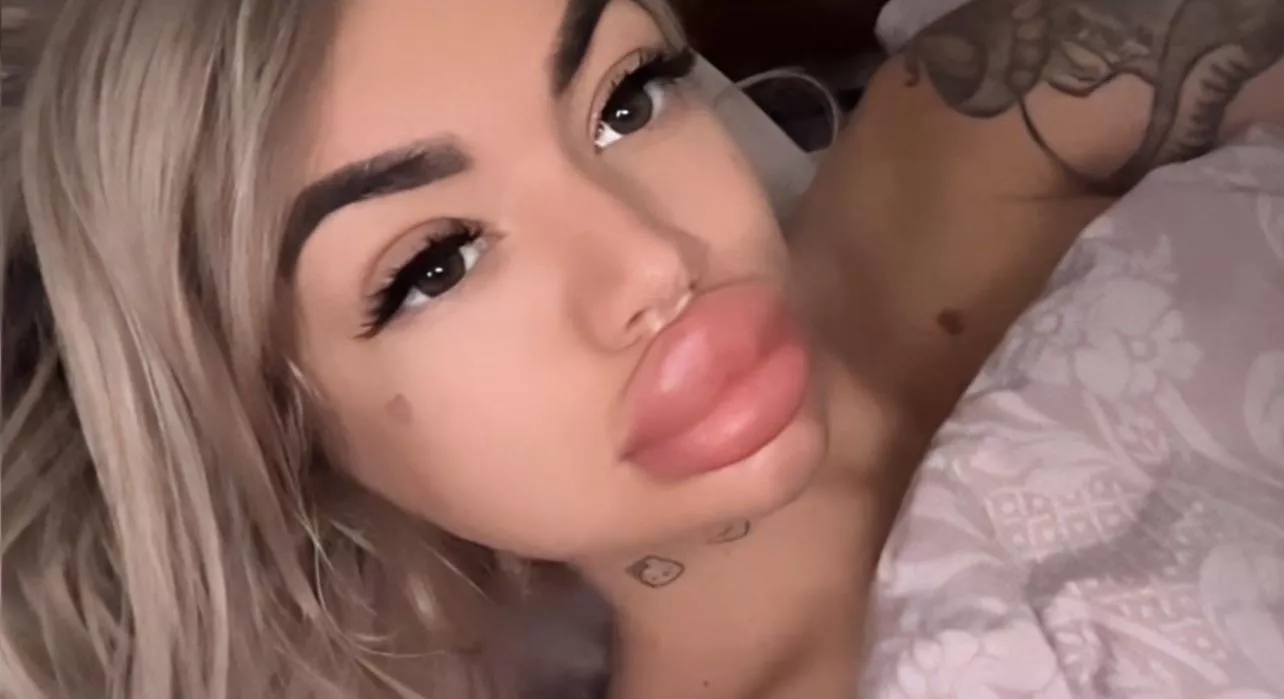 Those lips are beautiful