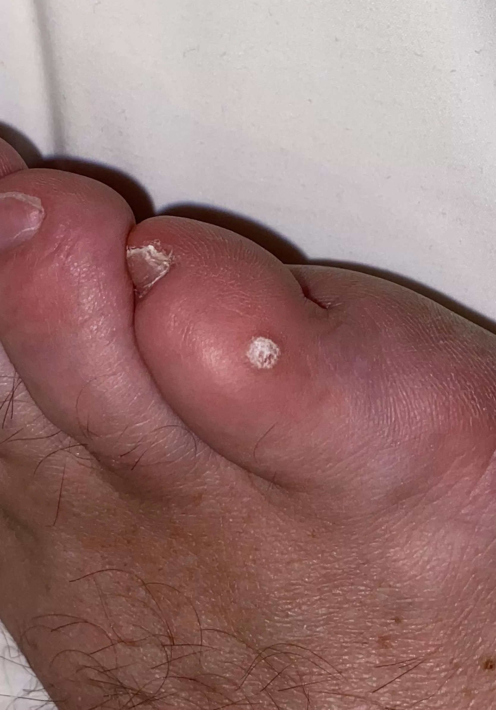 What is that at my toe?