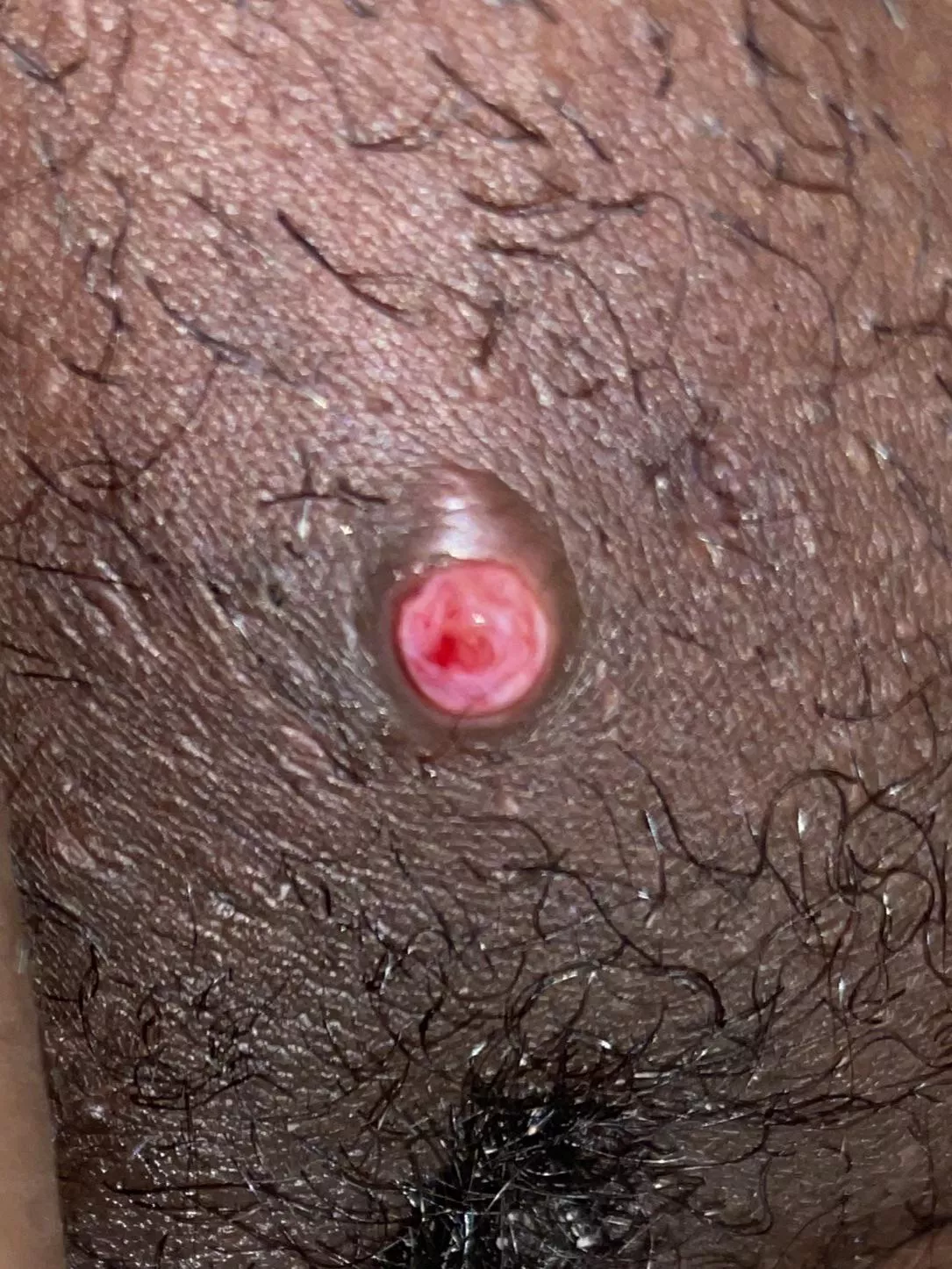 What is this? Itâ€™s super painful.