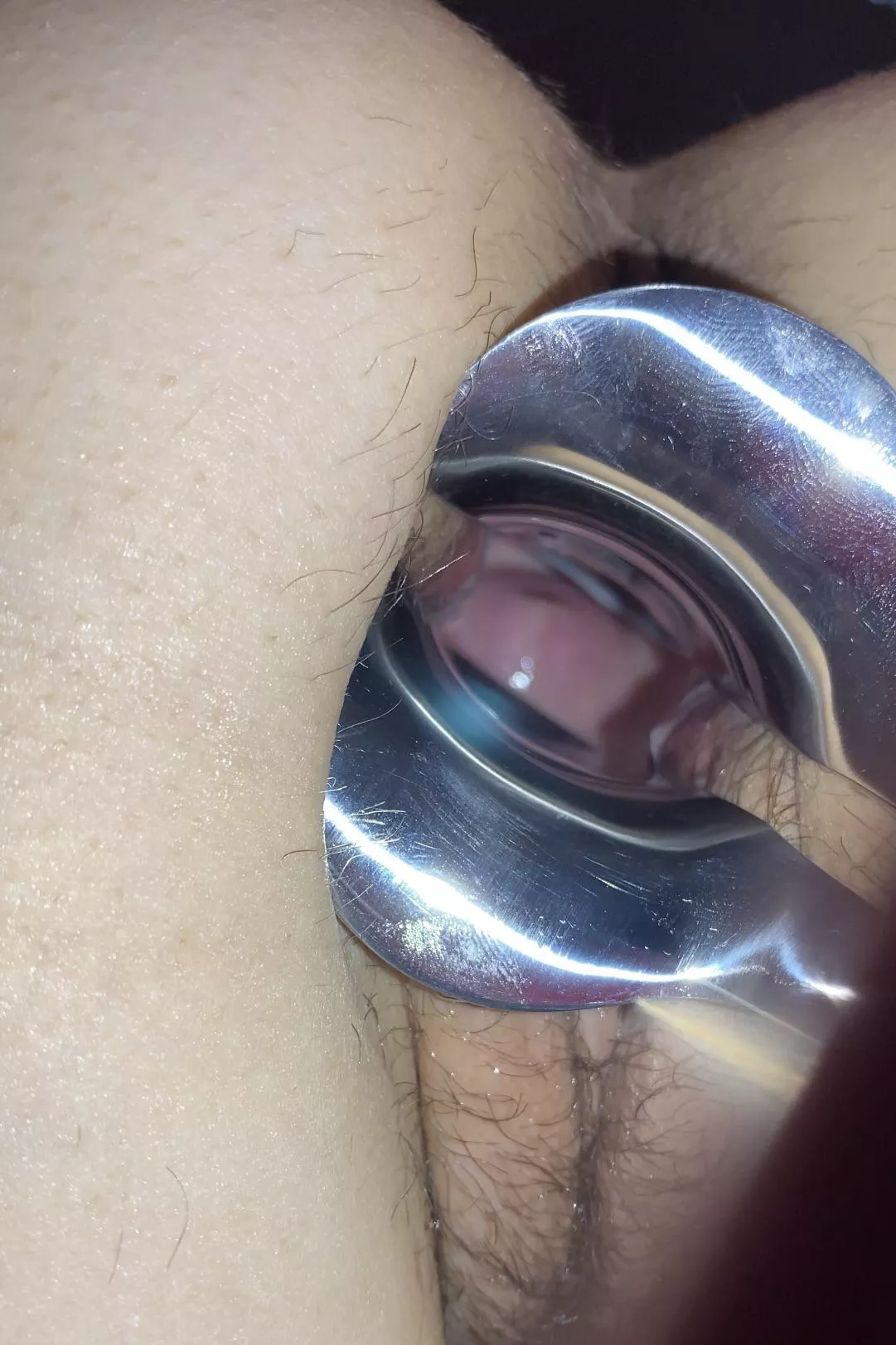 [F] Cervix pussy gape