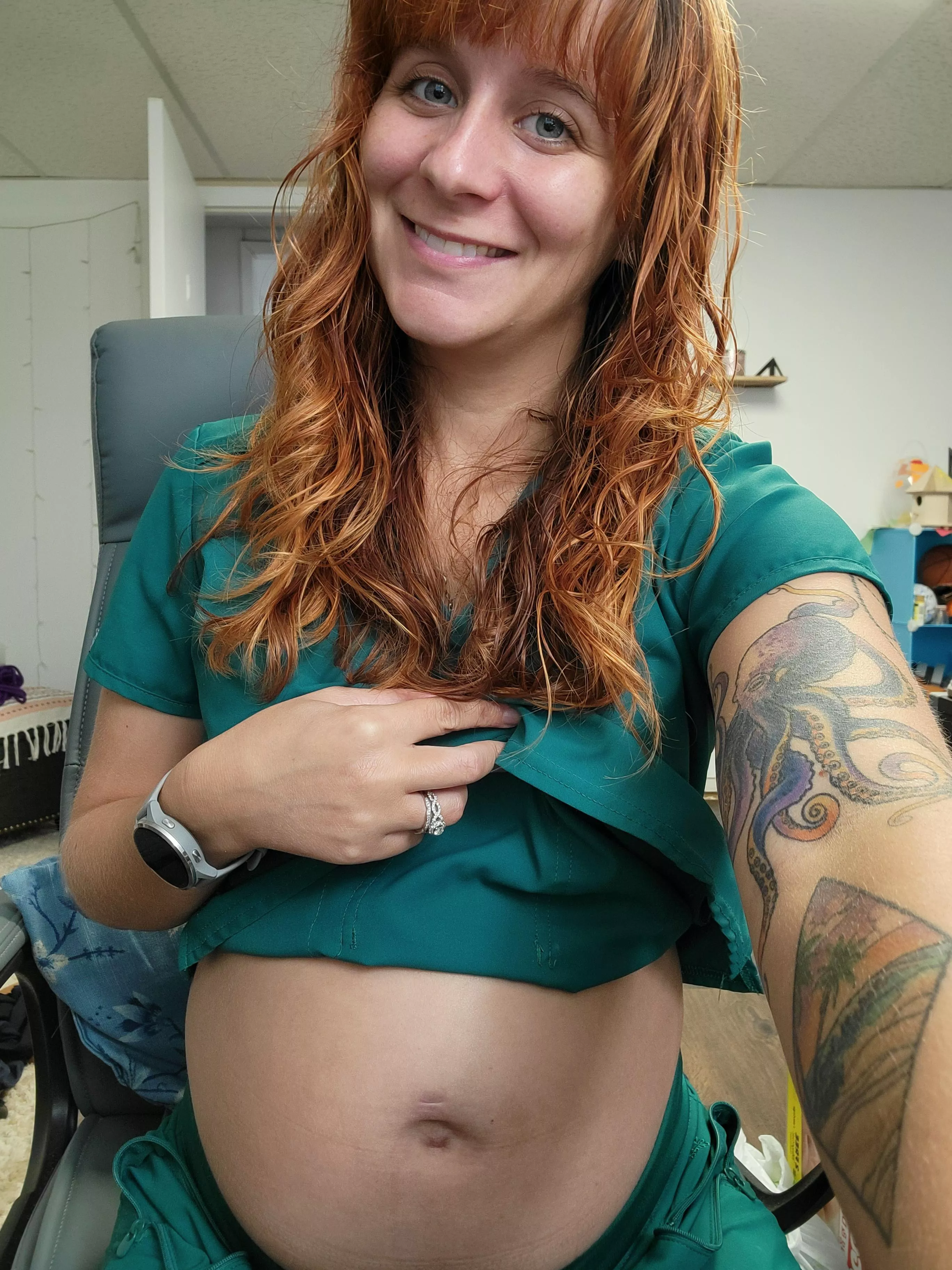 bellybutton update! 6MO