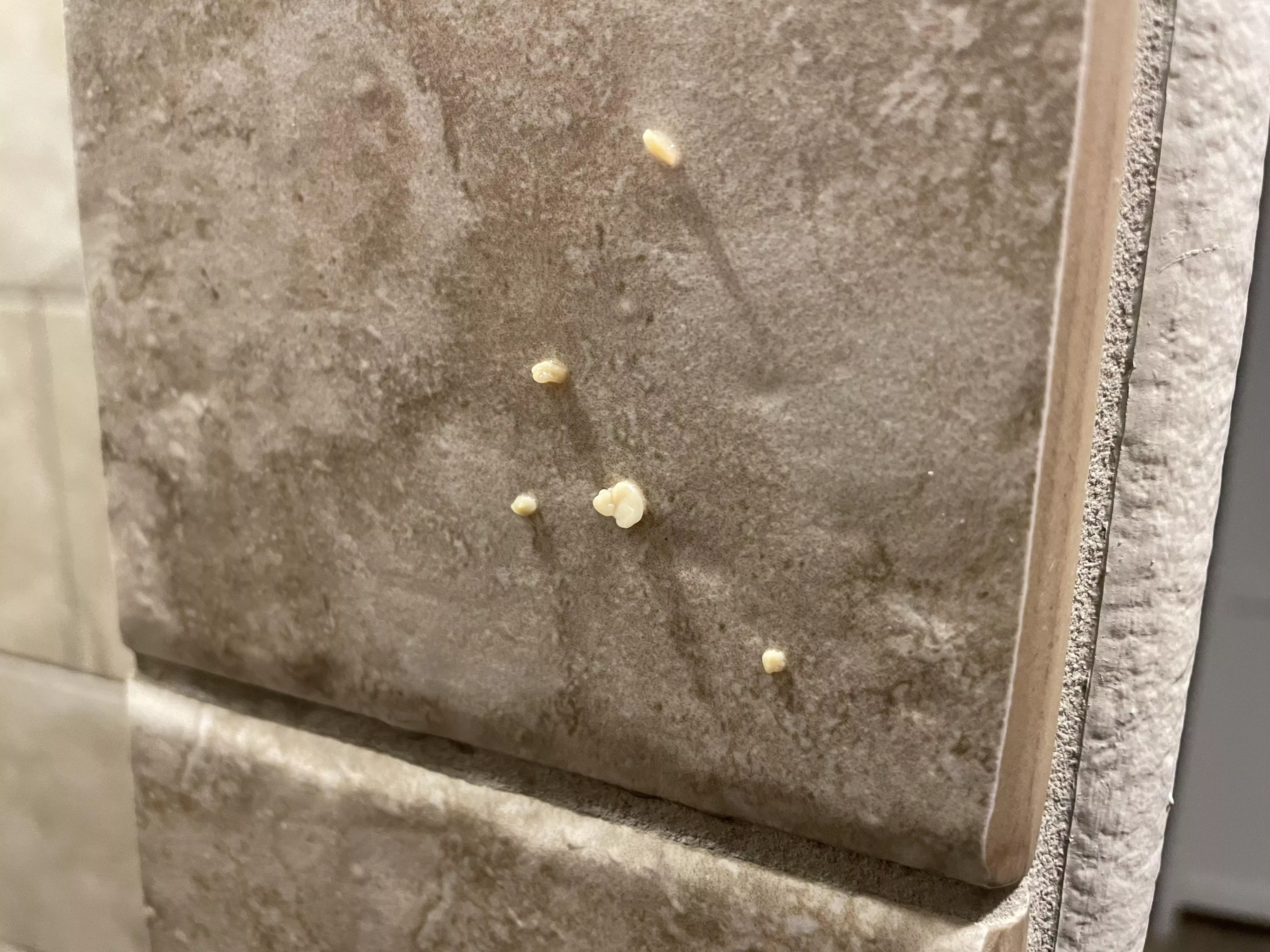 I hacked up these tonsil stones from my throat this morning in the shower