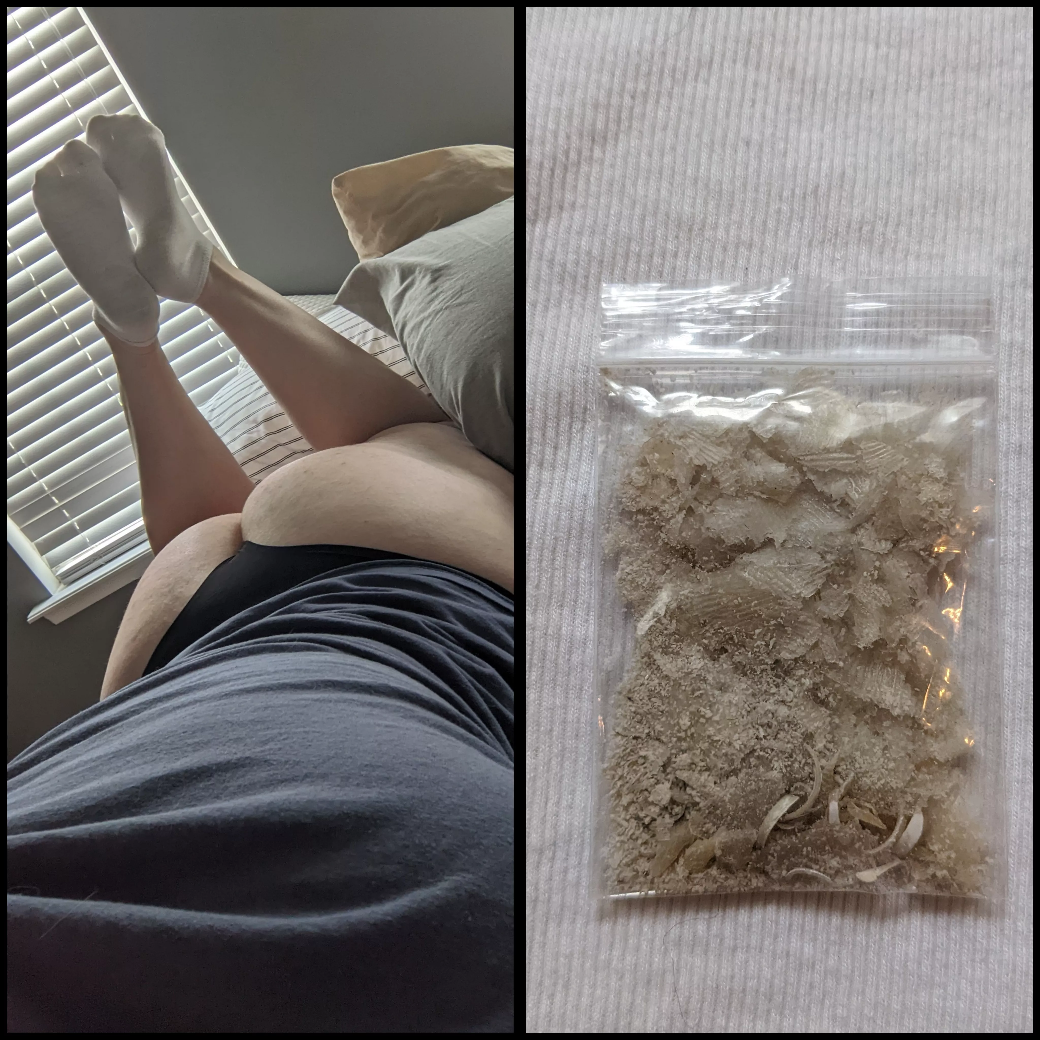 Ran 37 miles this week. Callus shavings and toe nails available as an add on or by itself. [Selling] DM or KIK M3GNIFIC3NT