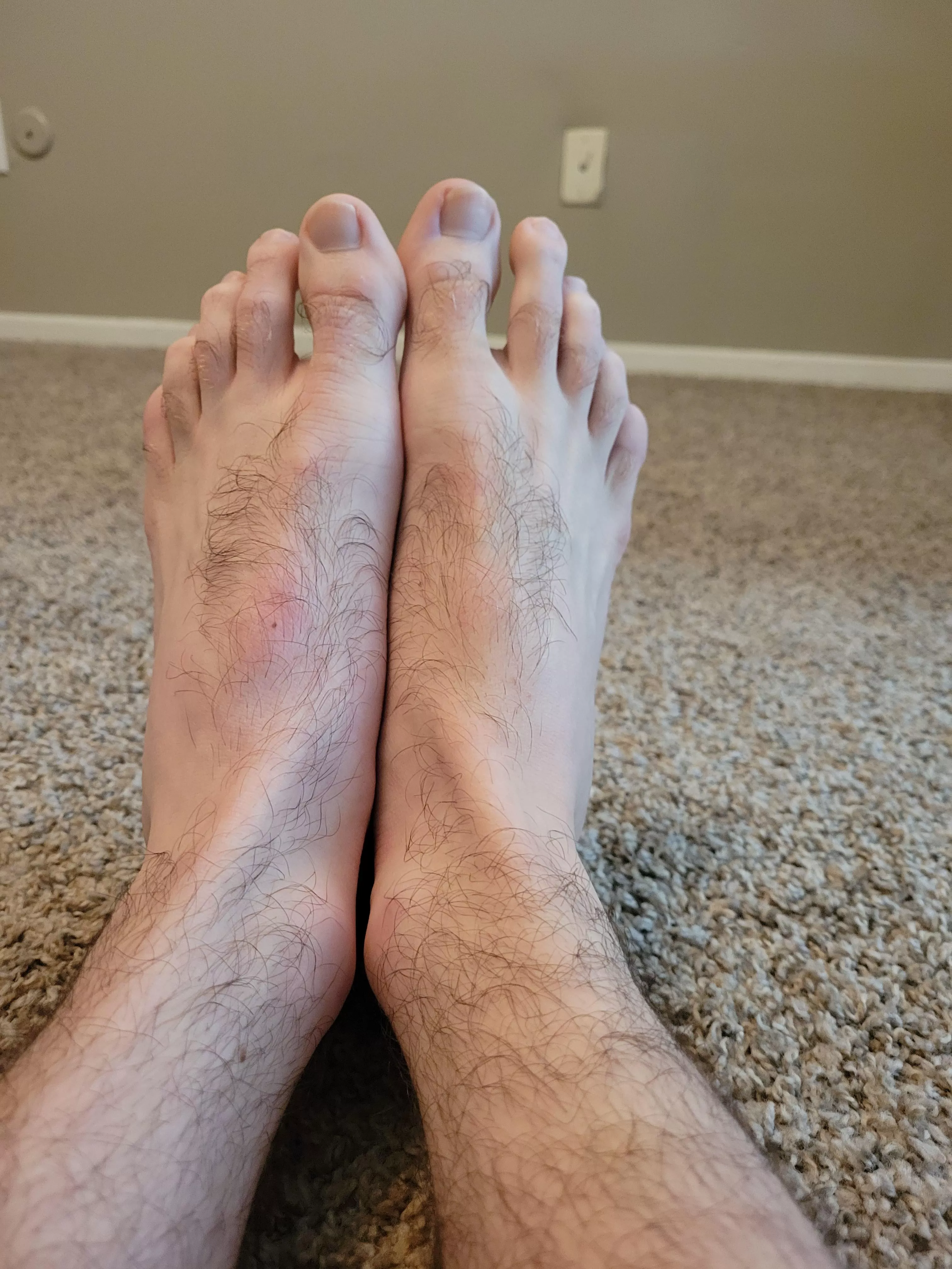 my feet are so hairy