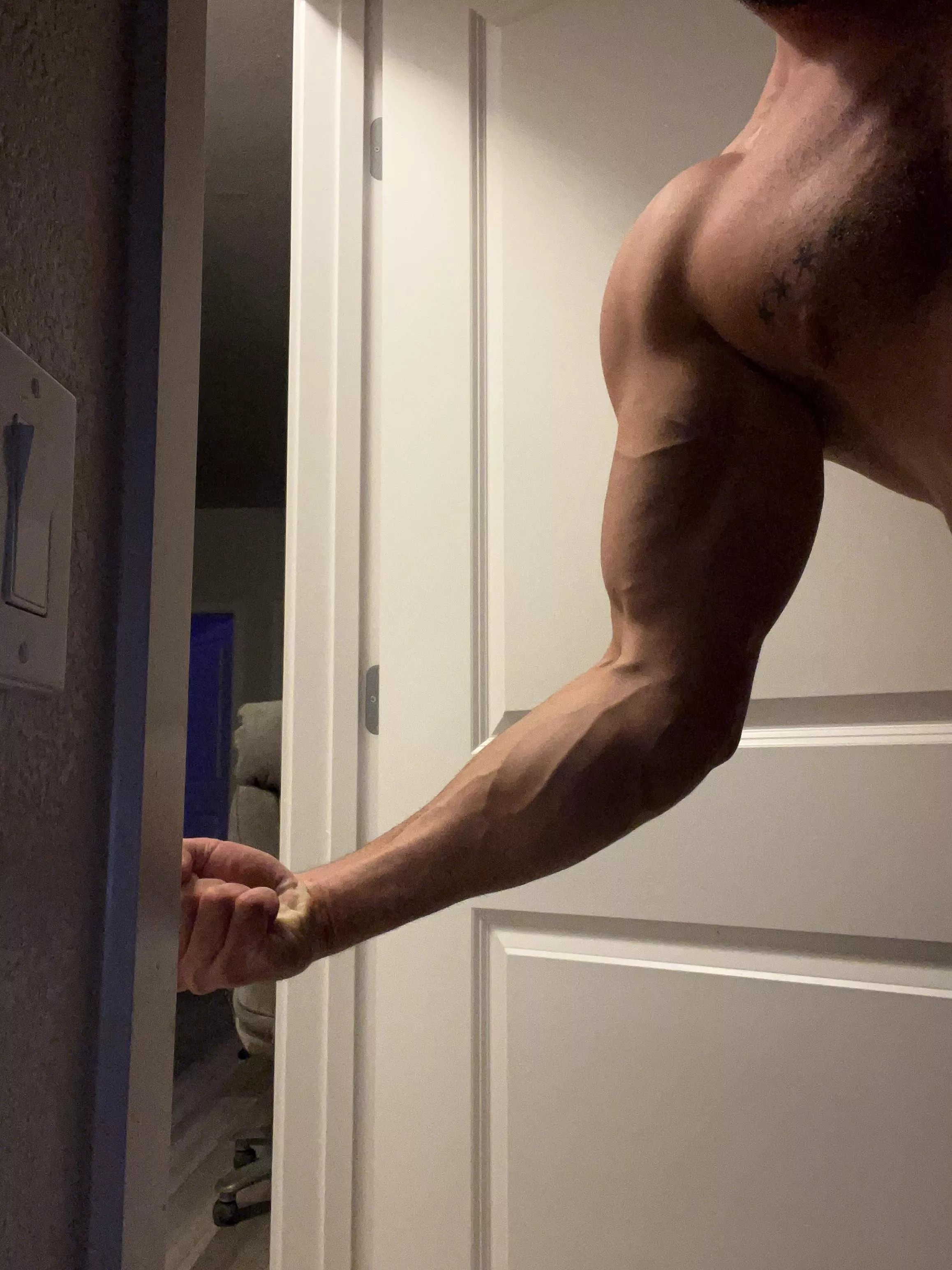 Opinion on veins?