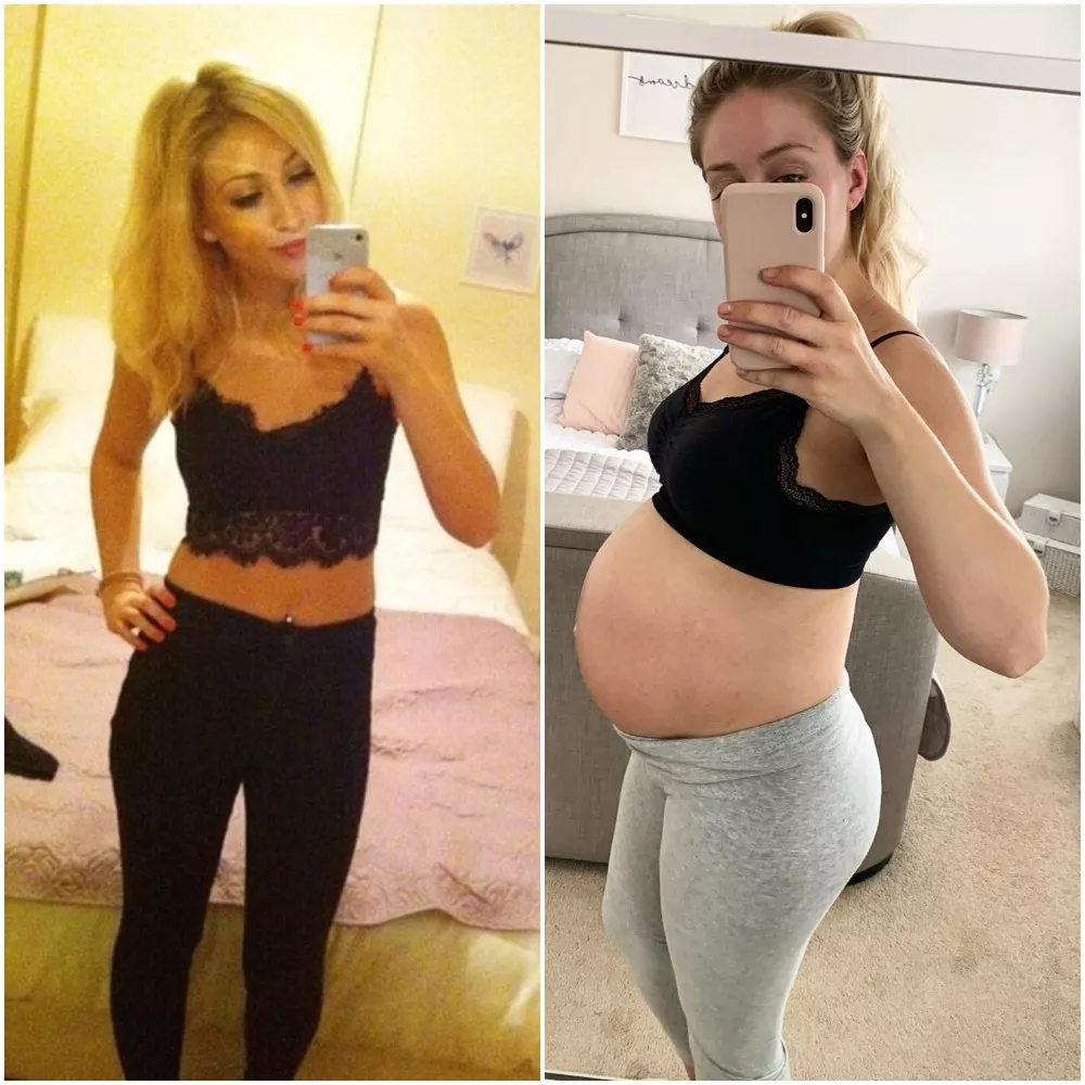 20 vs 24 and pregnant