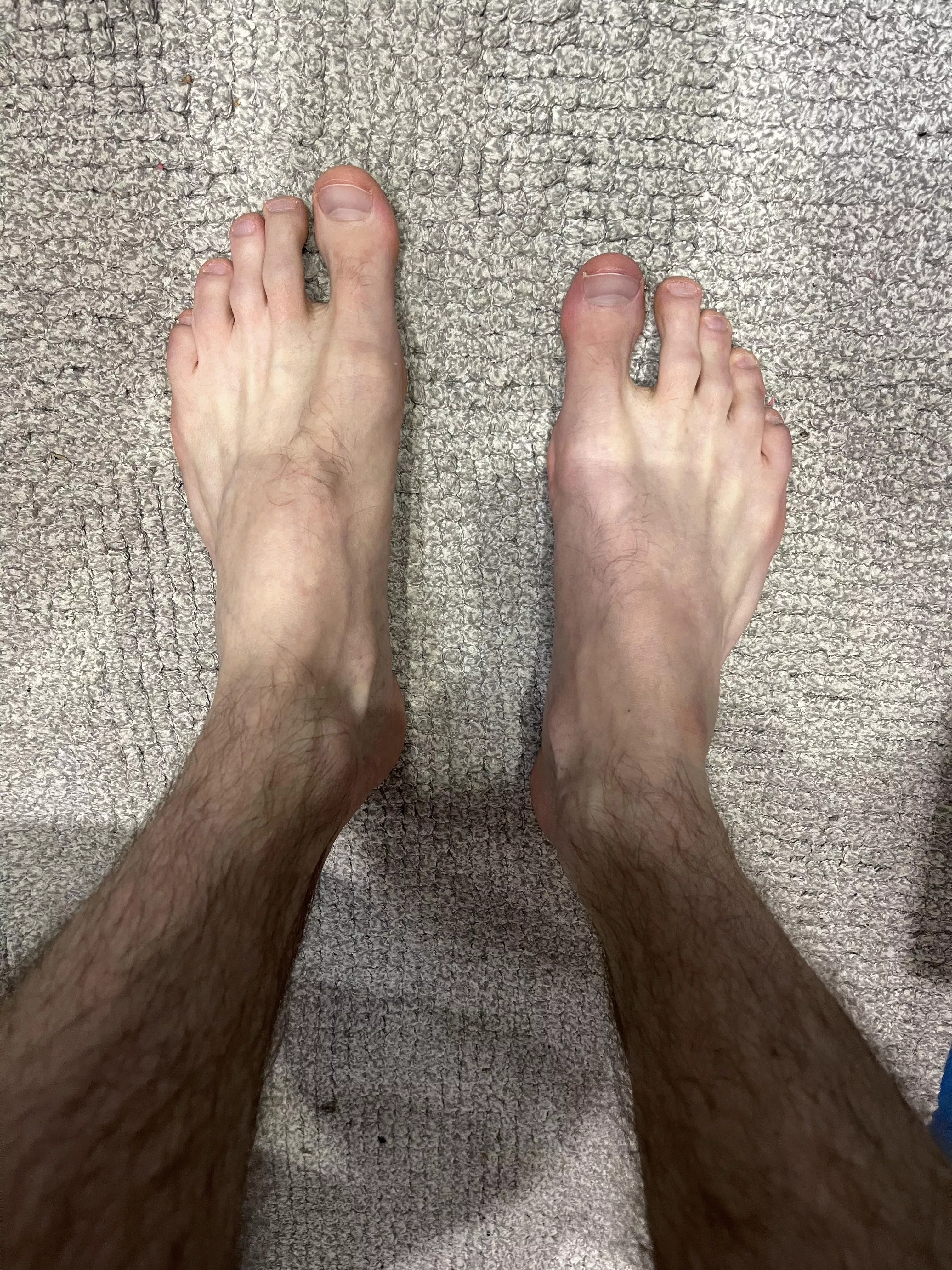 Redditors keep asking me to post my feet, here ya go ðŸ™ˆ