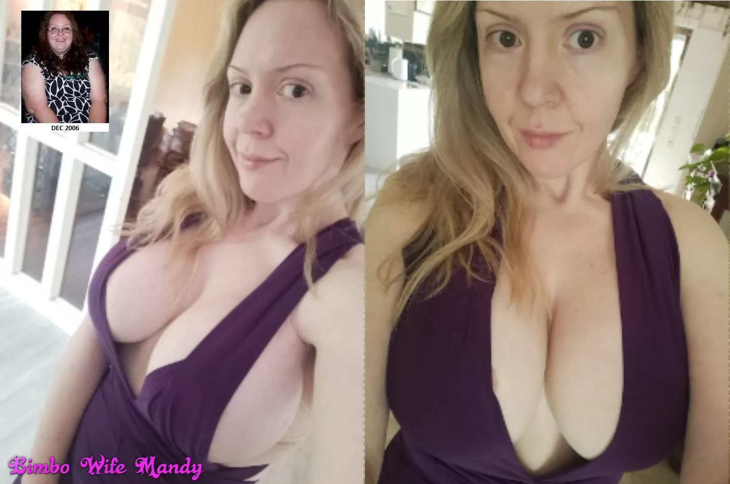 37 year old MILF Bimbo transformation (implants, lip fillers)! How am I doing? What should I do next? Do you want more?