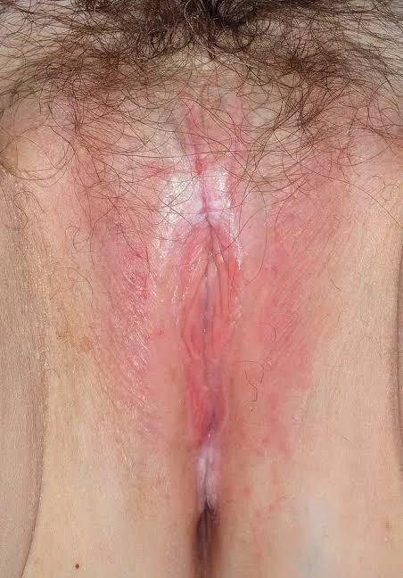 82 yo Atrophic pussy ...I love it