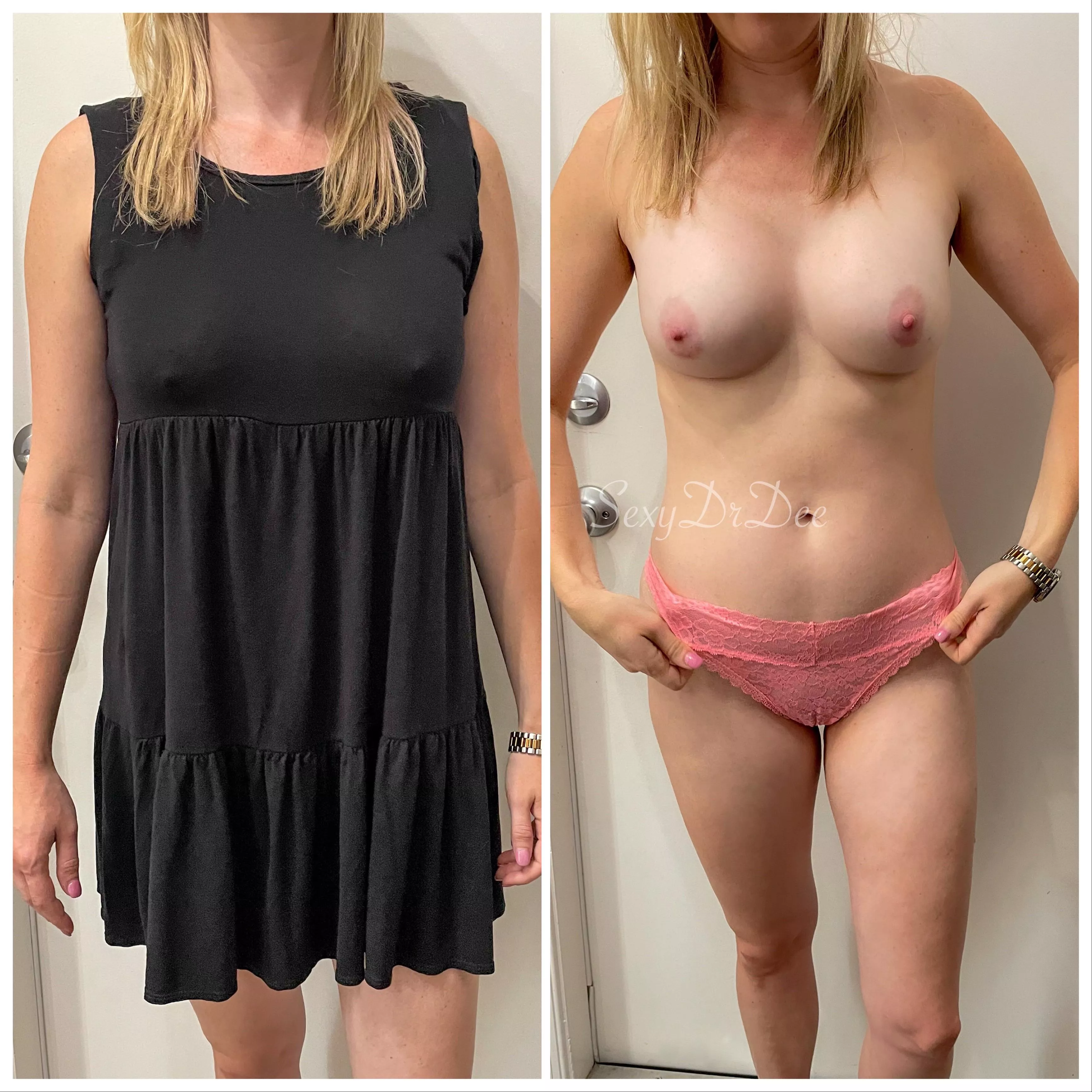 36 year old mom dressed and undressed