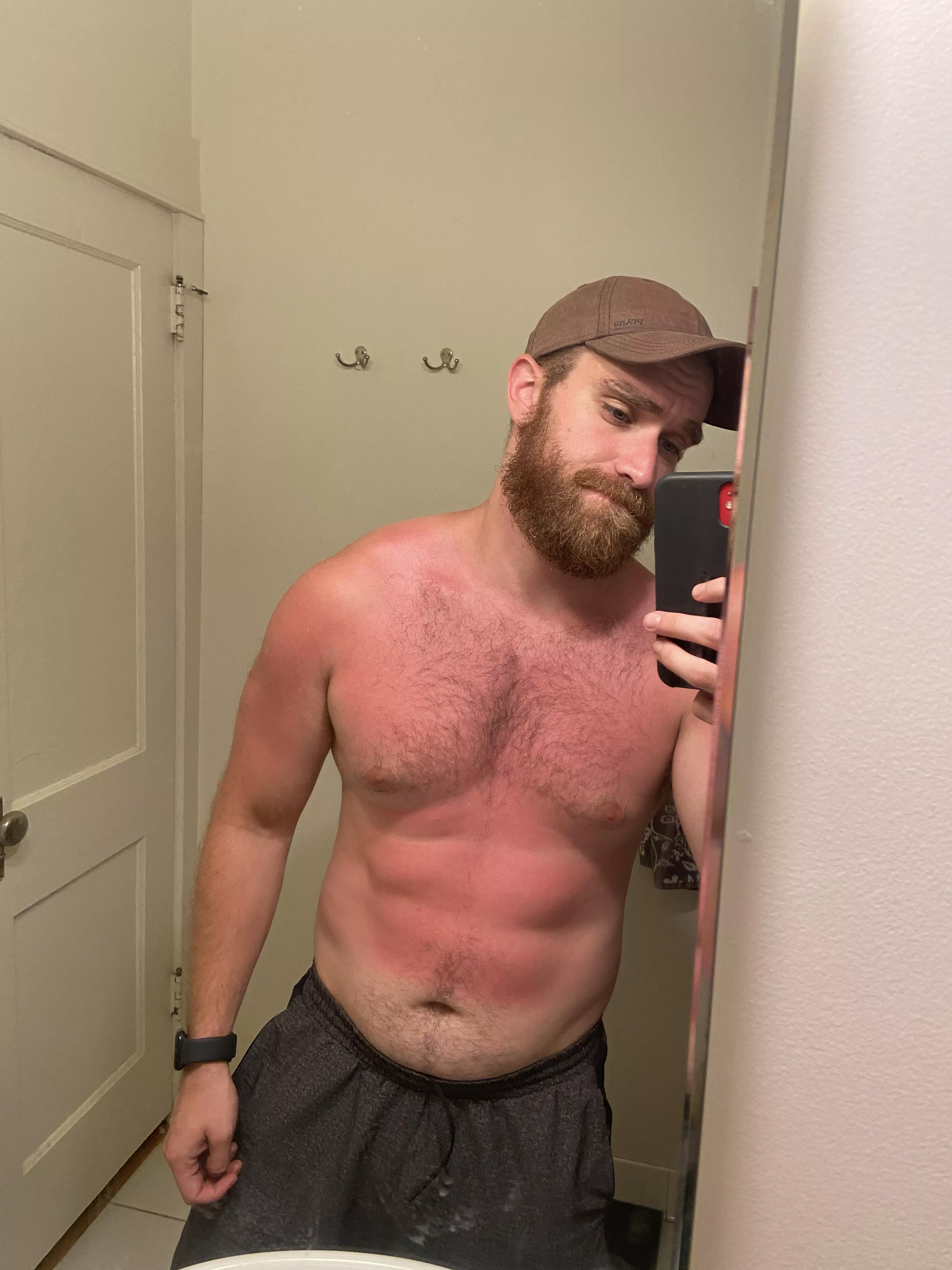 Itâ€™s not too late to get a sunburn