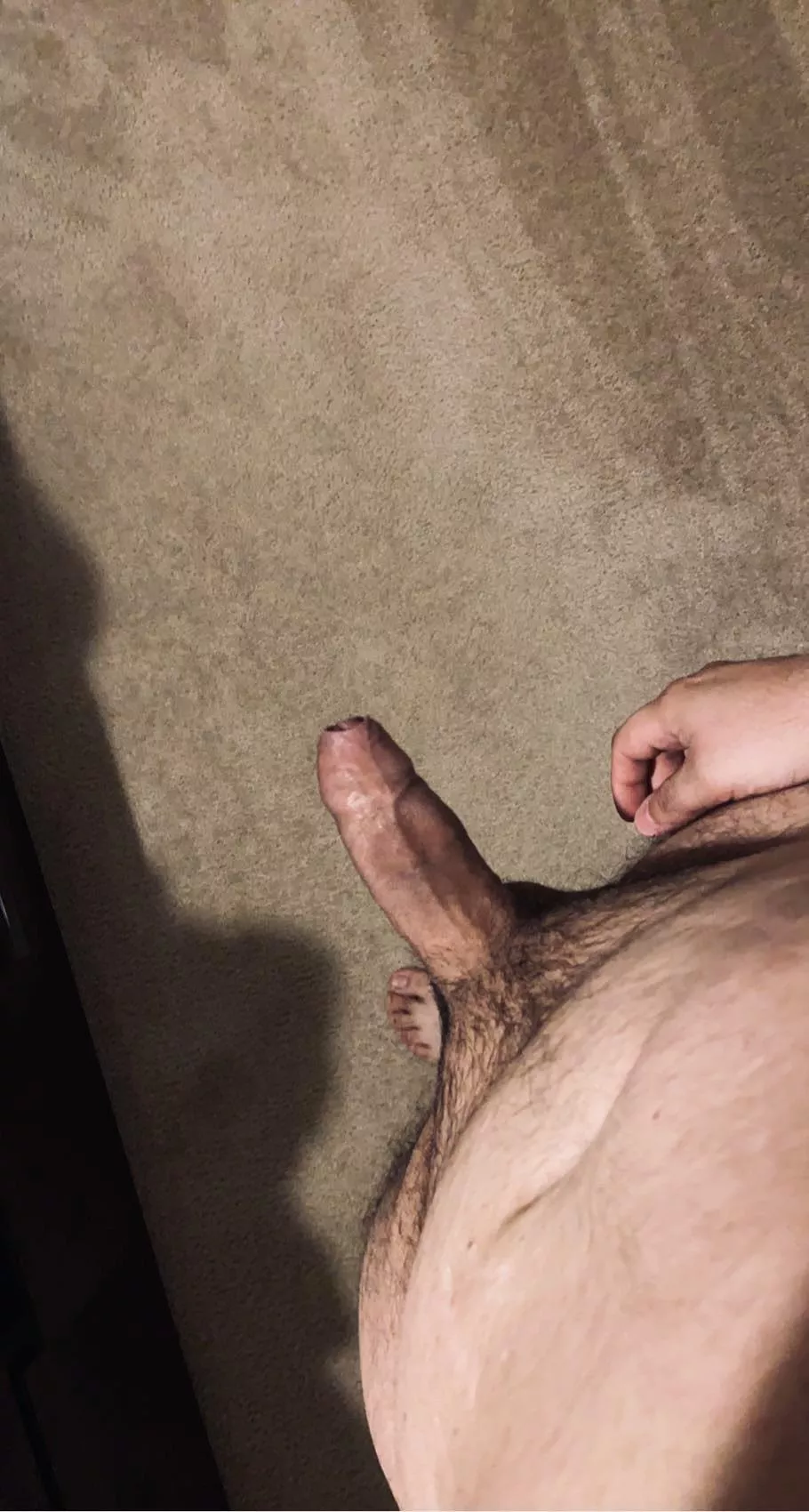 First time posting my foreskin