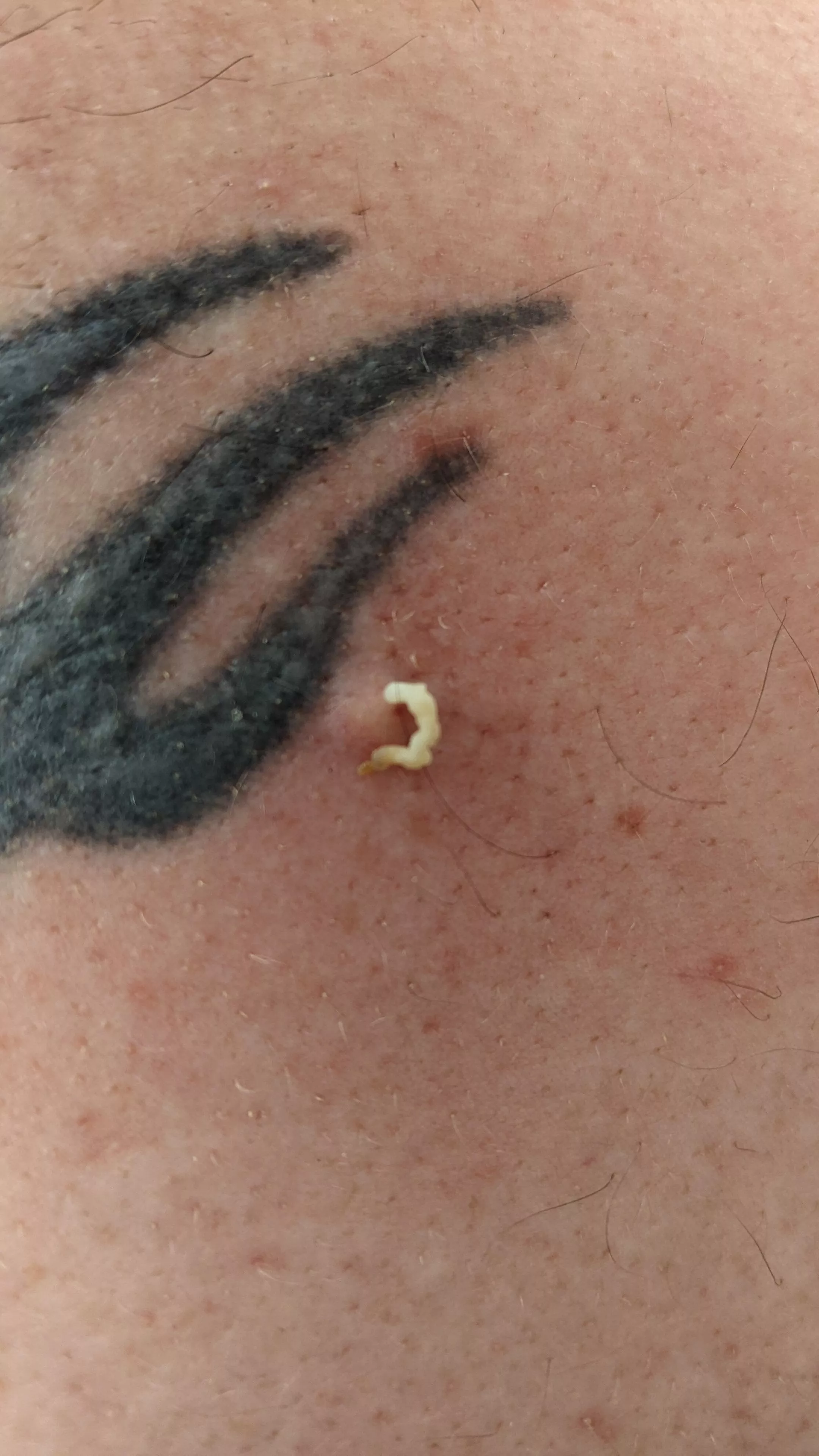 Small Blackhead. This was only half of it.