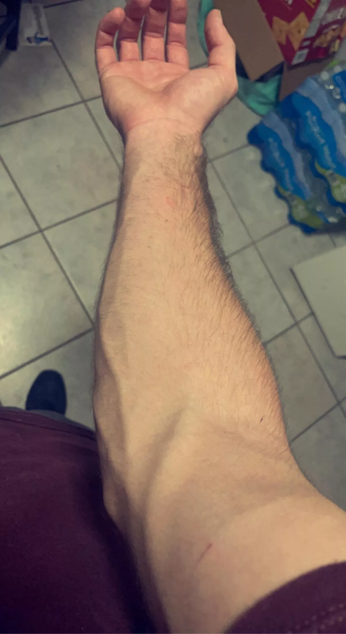 20 years old, arms are starting to get big :)