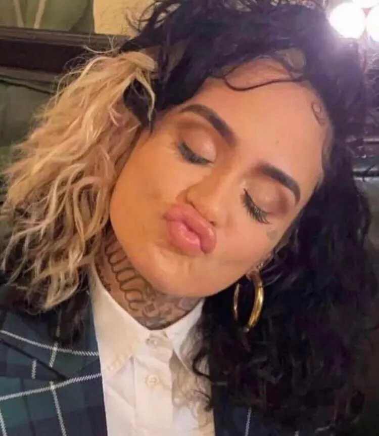 Kehlaniâ€™s plump lips