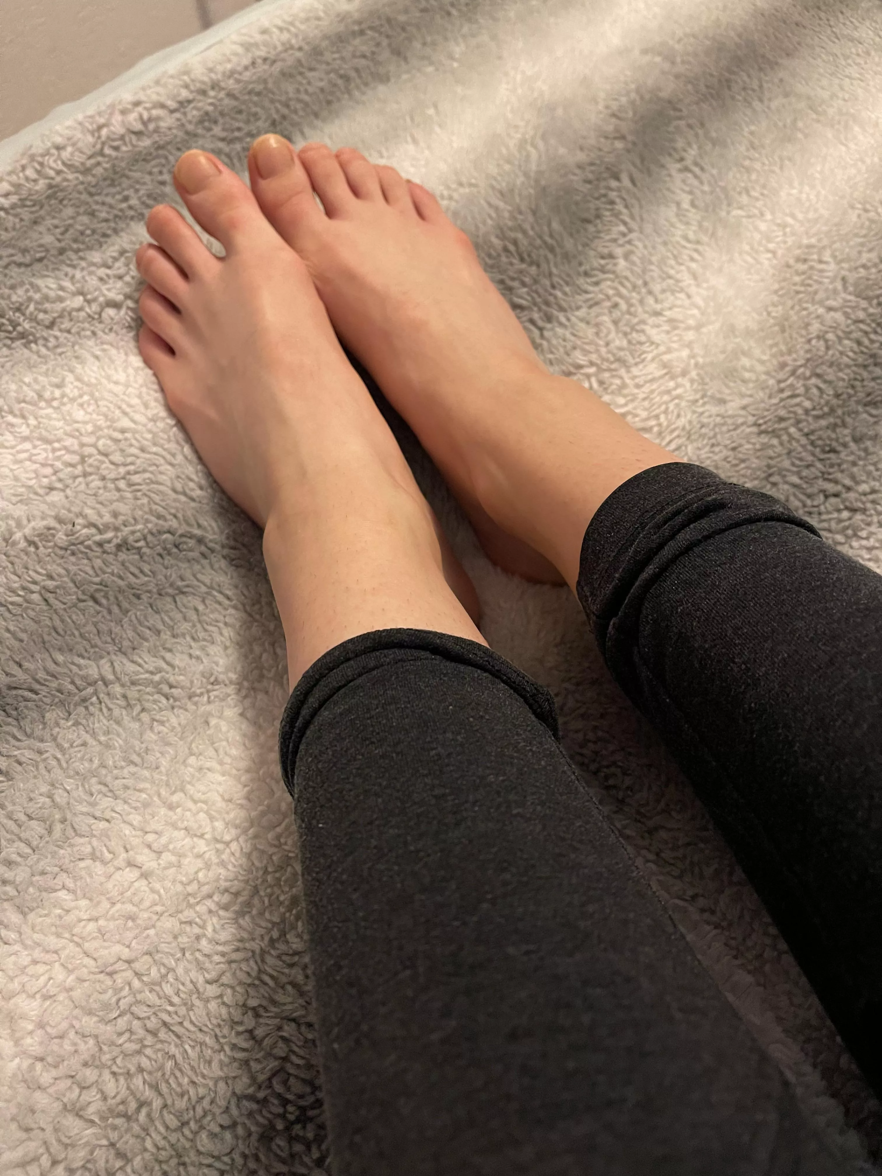 Do I have ugly feet?