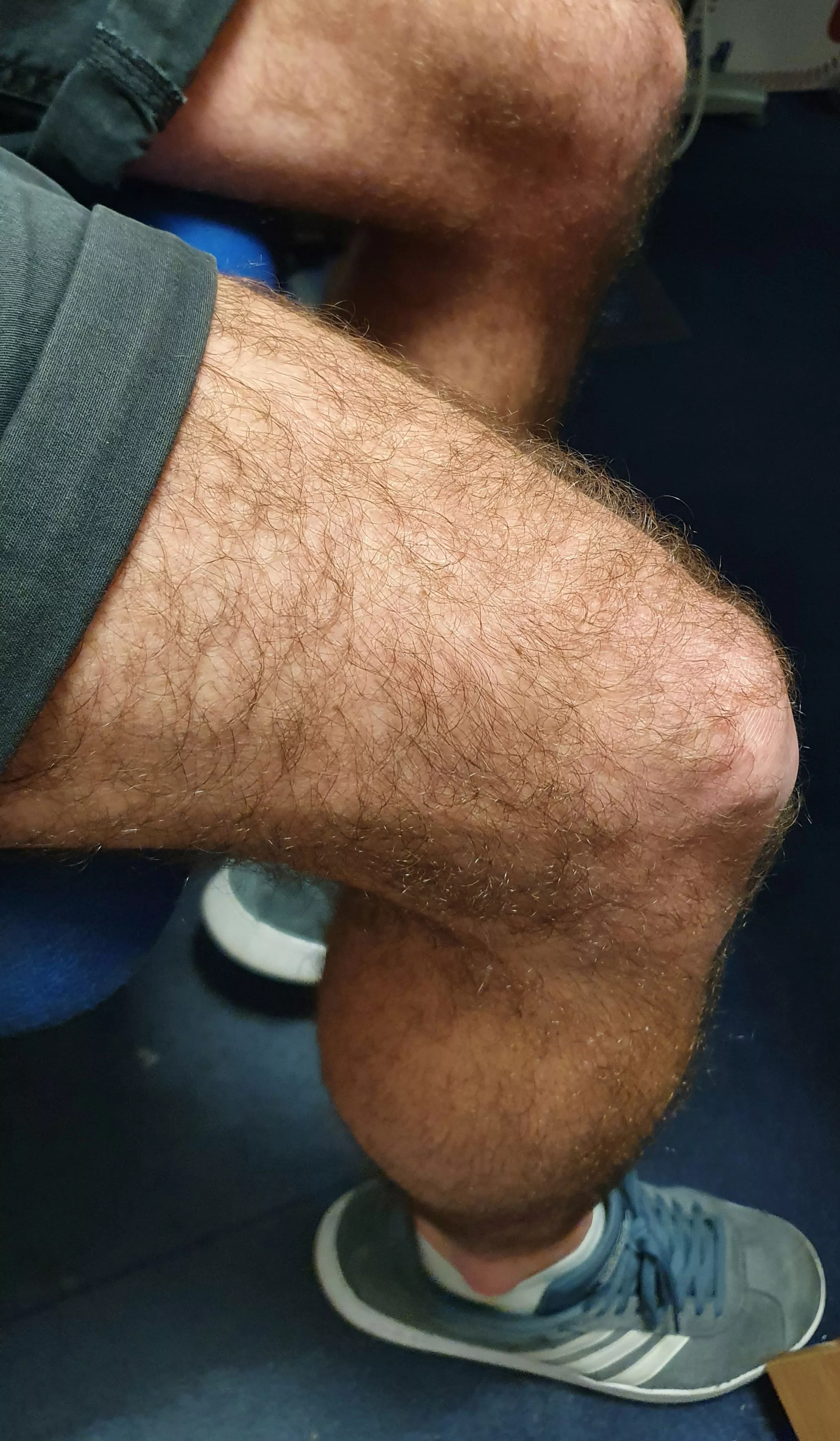 For hairy legs fans