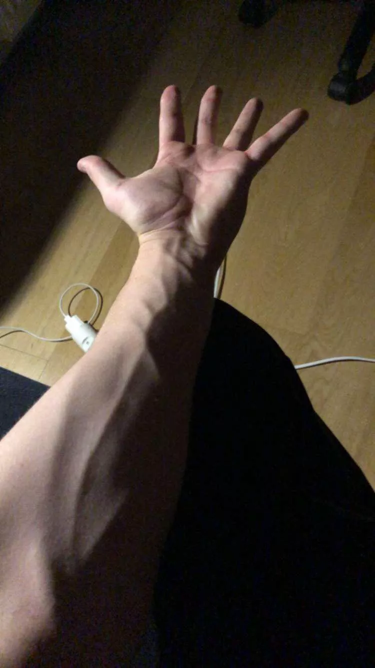 How is the forearm looking?