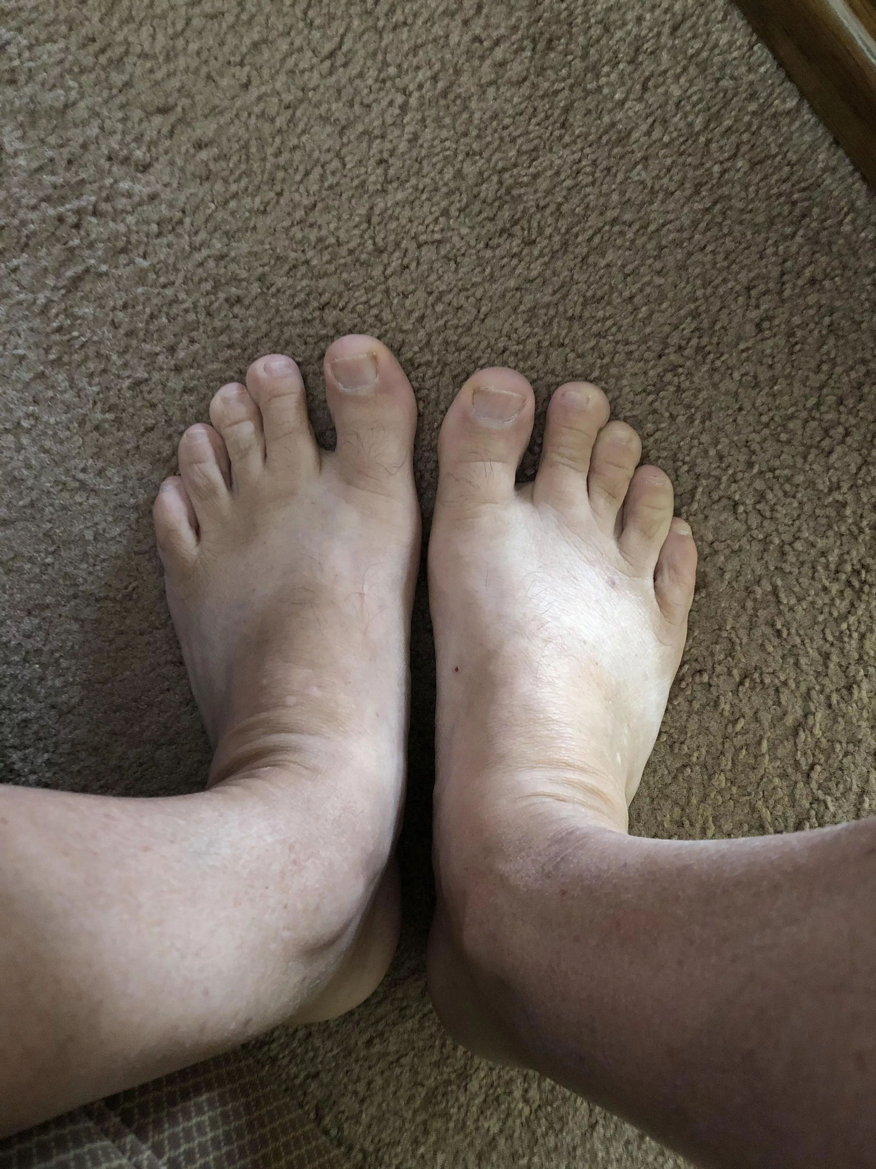 My 65 year old feet