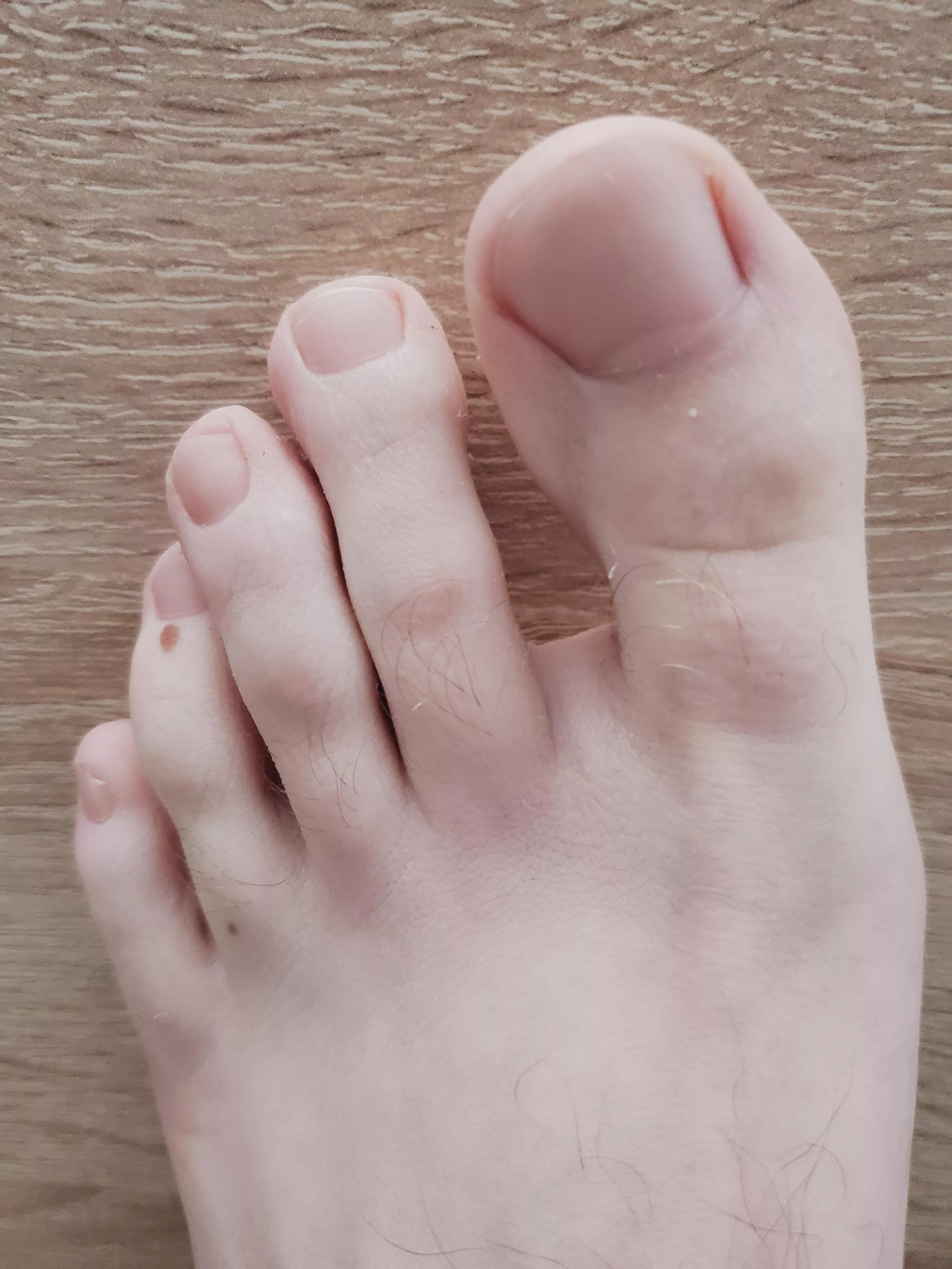 Some people told me that I have pretty toes! What's your thoughts? ðŸ˜‹