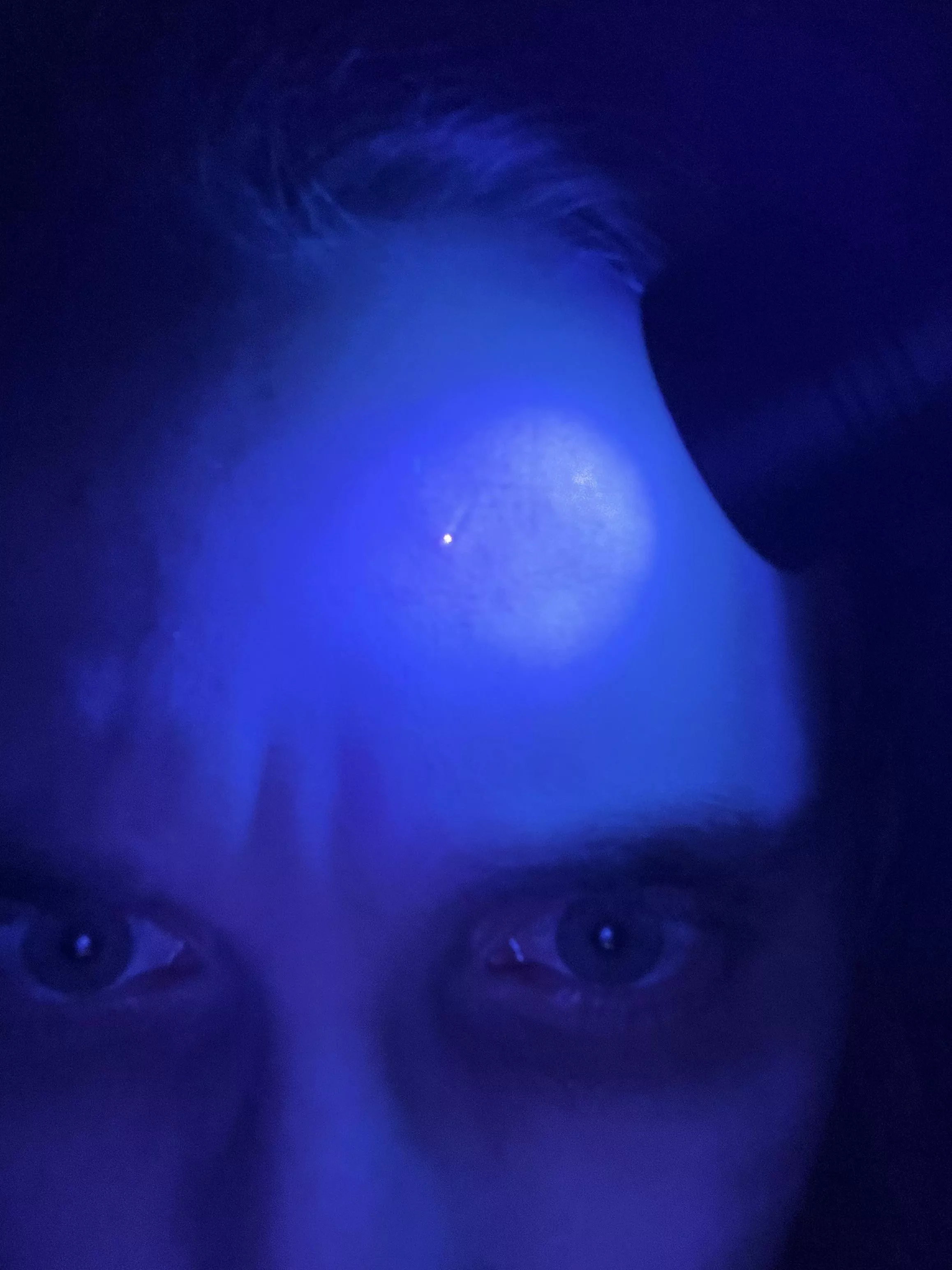 Blackhead glowing *bright* orange under a blacklight. All the pores on my cheekbones, nose, and chin do this too but not as bright as this blackhead.