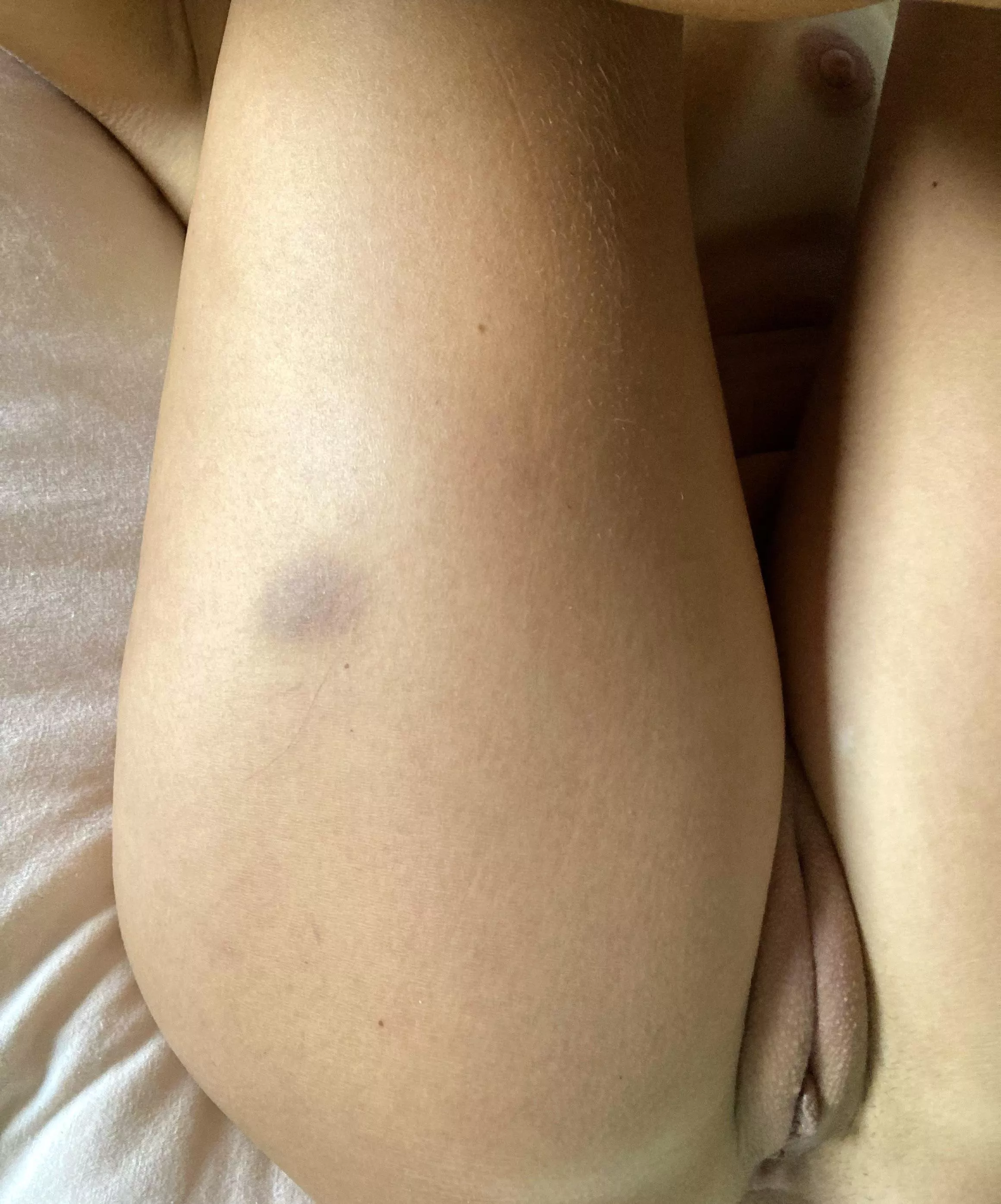 Little bruise