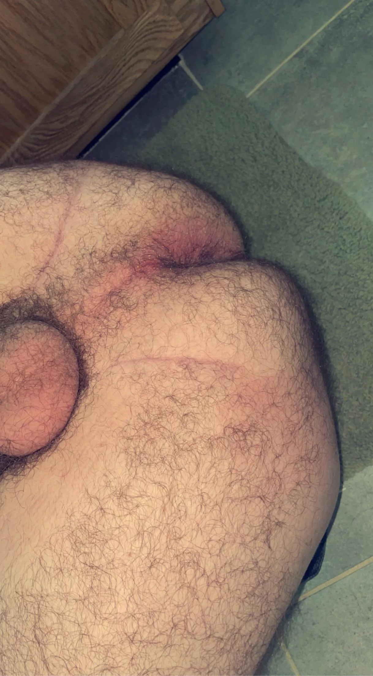 23 Hairy bottom - DMâ€™s open