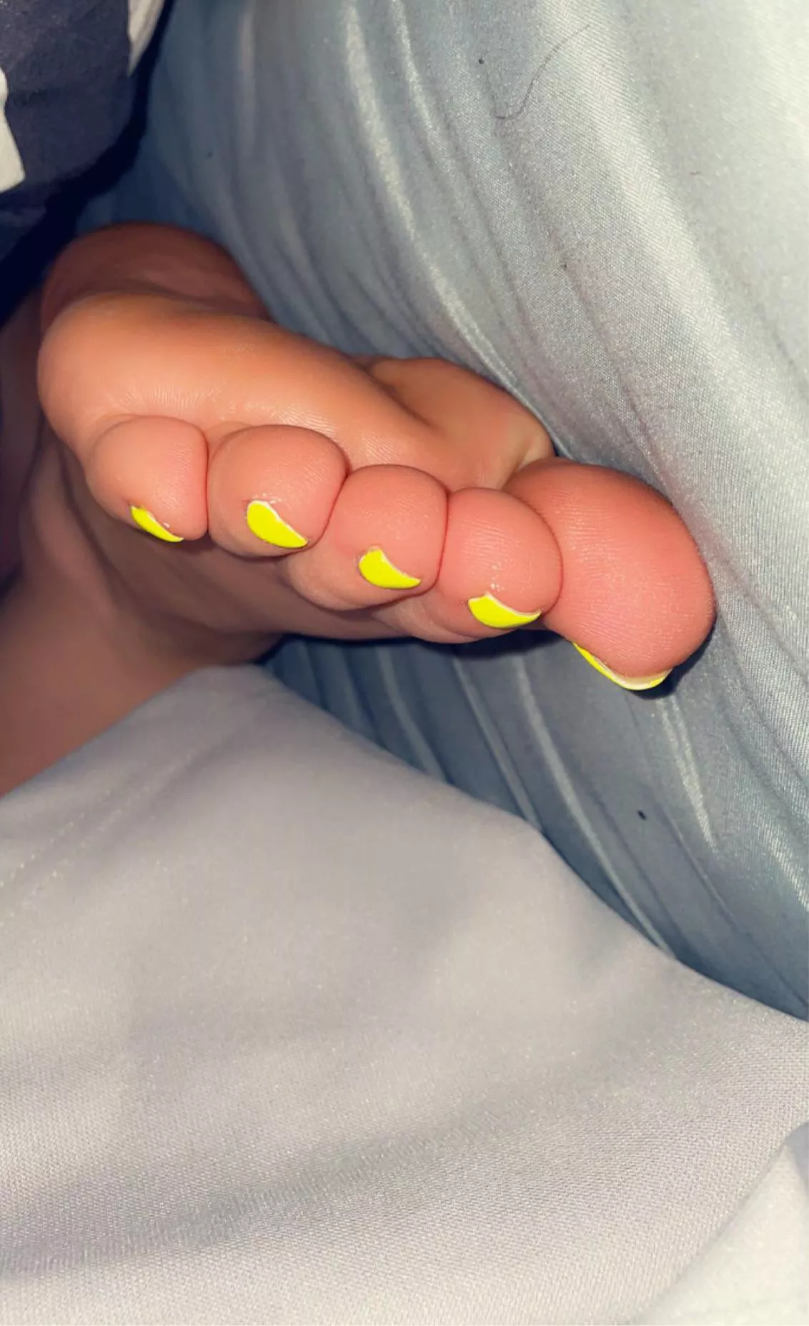 How does my yello pedi look