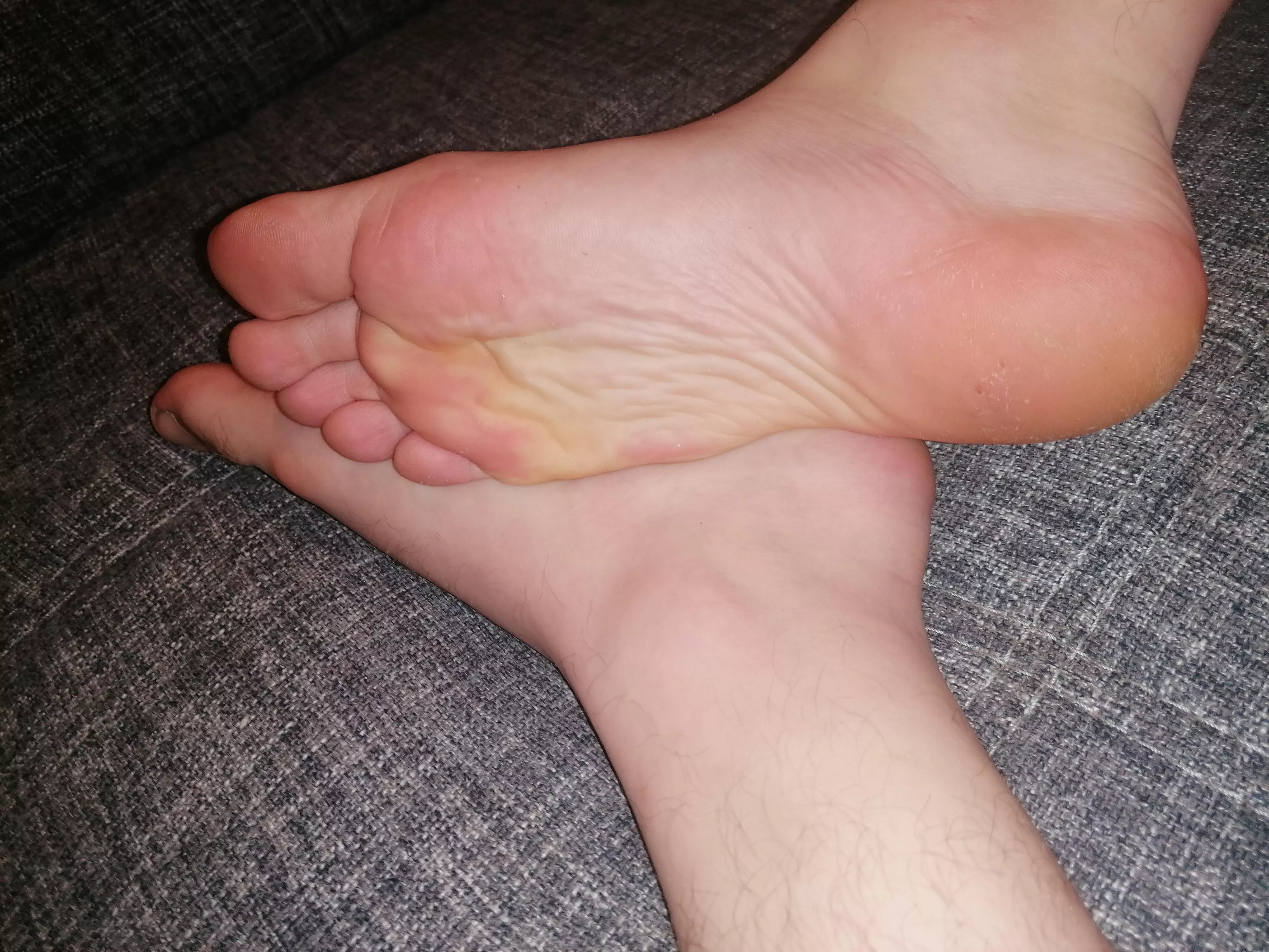 A few pics of my feet for you guys