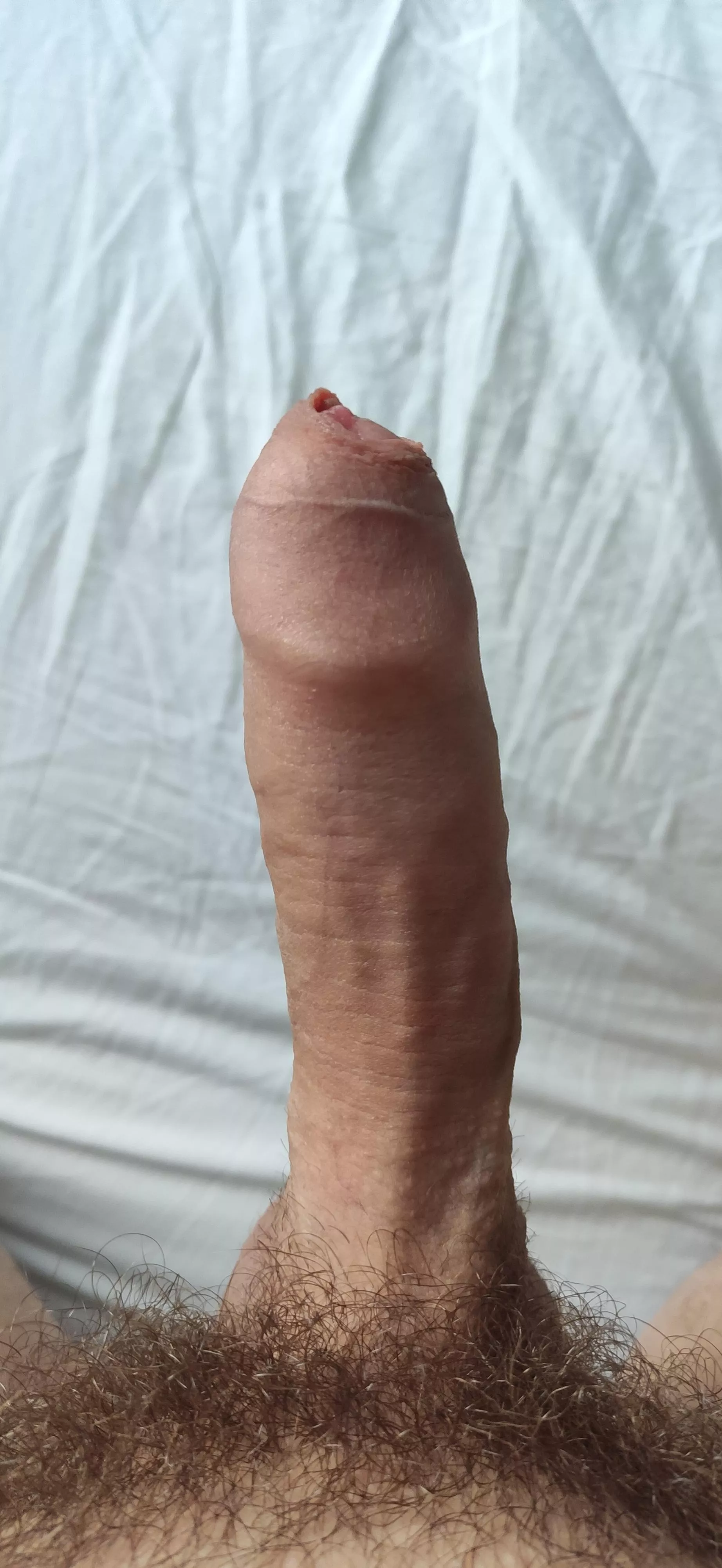 I'm quite insecure about my foreskin. How to overcome it?