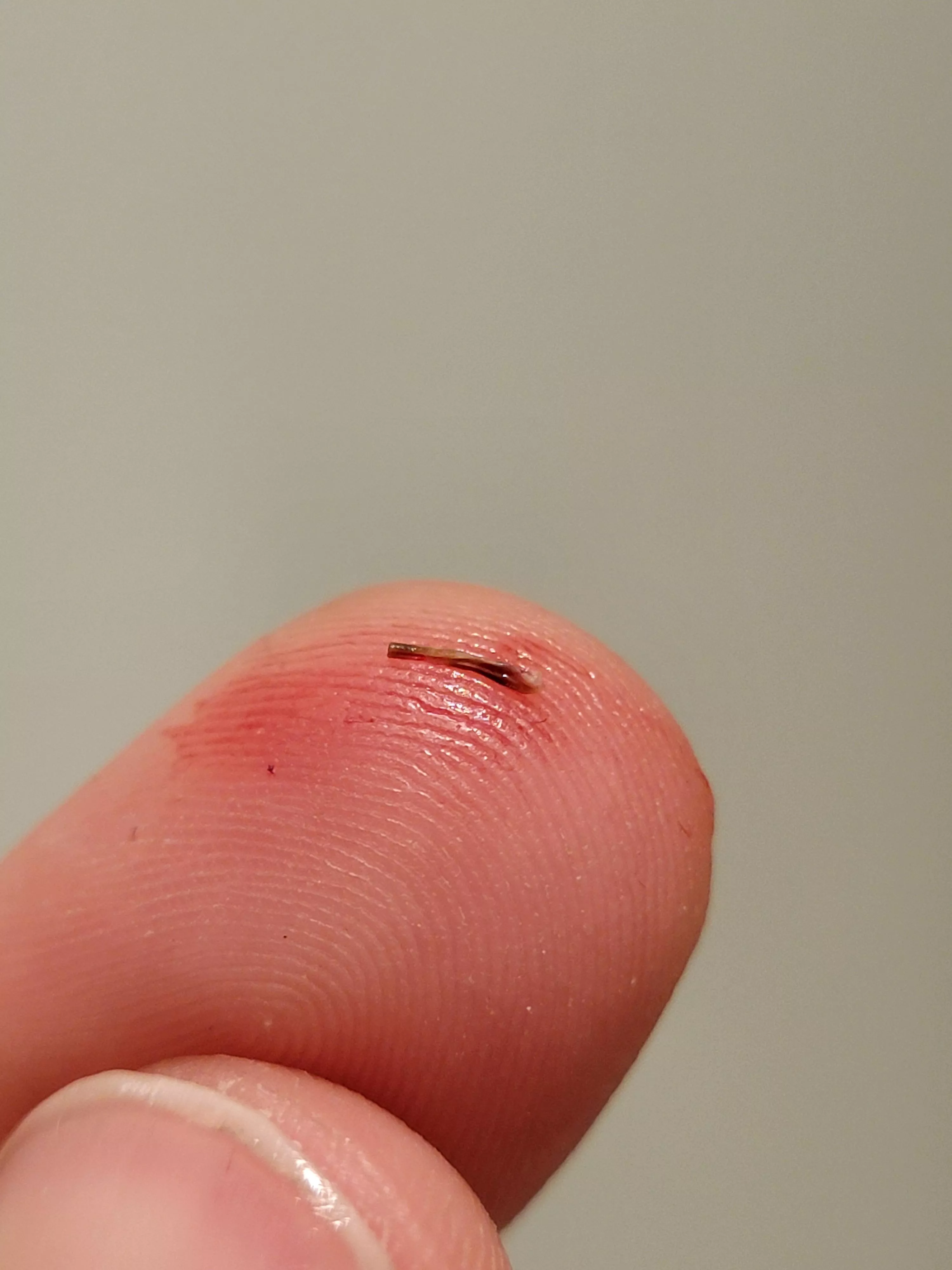 Just had this pop out of my chin earlier