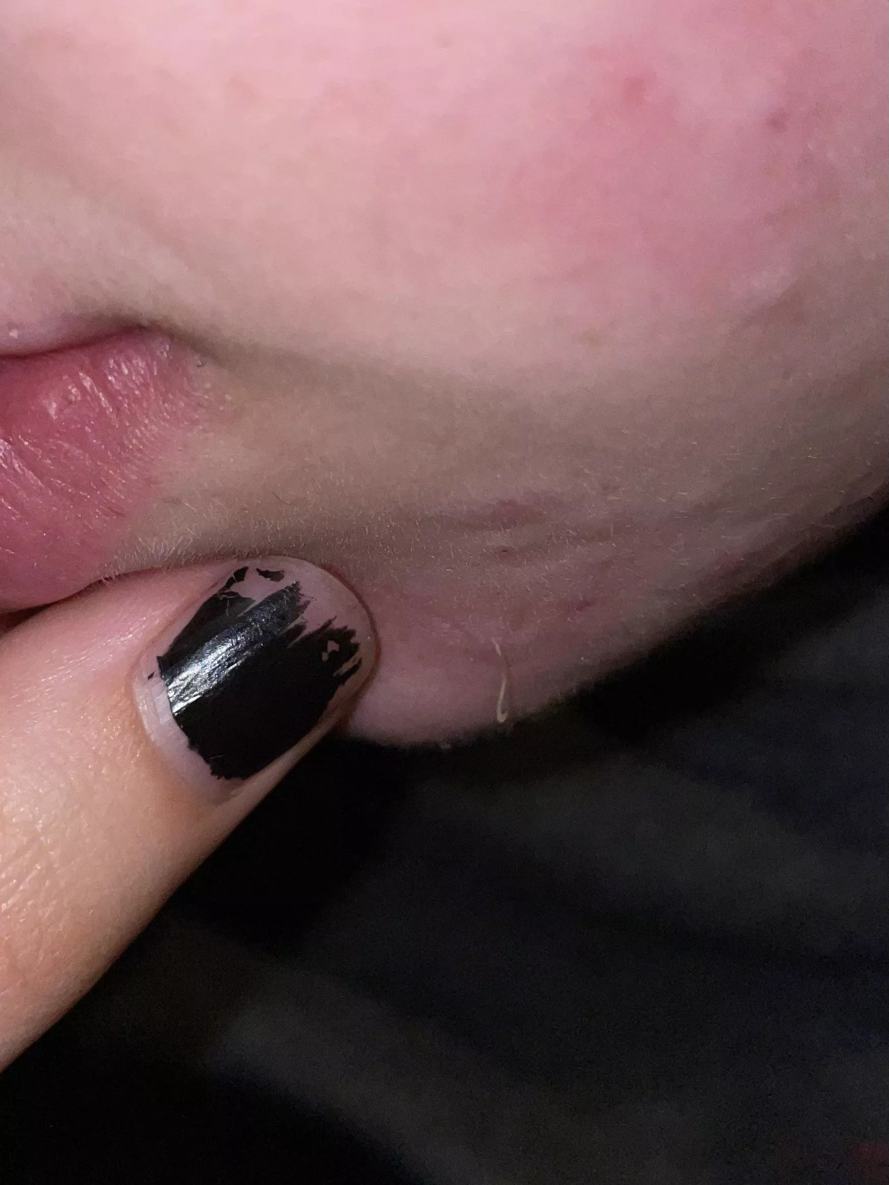 Blackhead from my boyfriend’s face lol